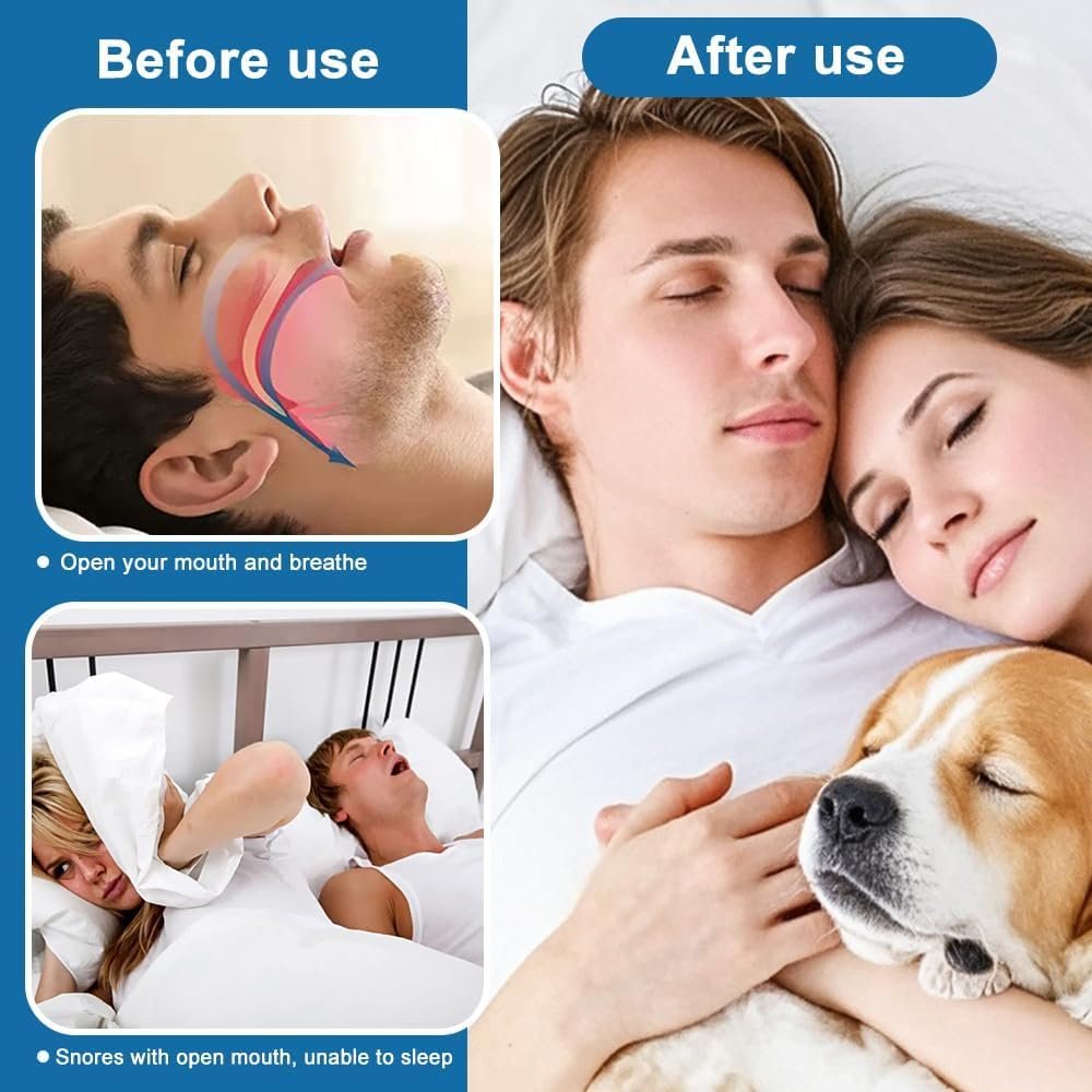 Тримач язика проти хропіння, ремінець на підборіддя, фото №6 Тримач язика проти хропіння, ремінець на підборіддя, фото №6