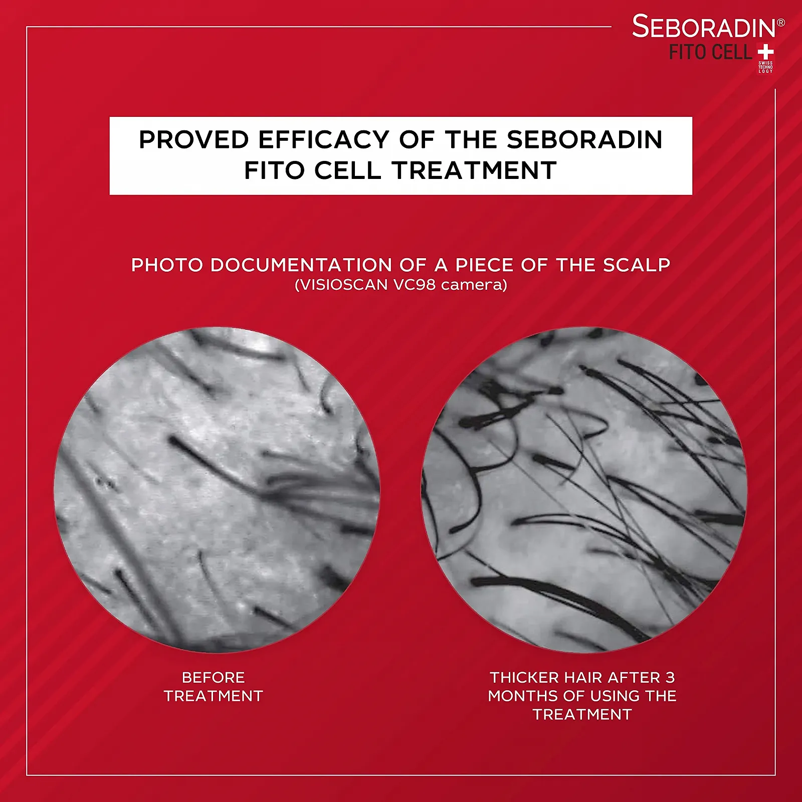 Сироватка Seboradin Fitocell проти випадіння та для росту волосся зі швейцарською технологією стовбурових клітин, 15 тюбиків x 6 г, фото №7