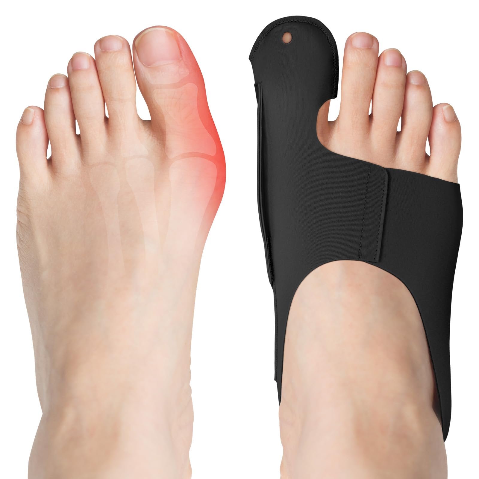 Корректор большого пальца стопы flintronic Hallux Valgus, 2 шт., разделитель для пальцев ног, набор для коррекции Hallux Valgus, бандаж Hallux Valgus для мужчин и женщин, защита большого пальца стопы (черный, M), фото №1