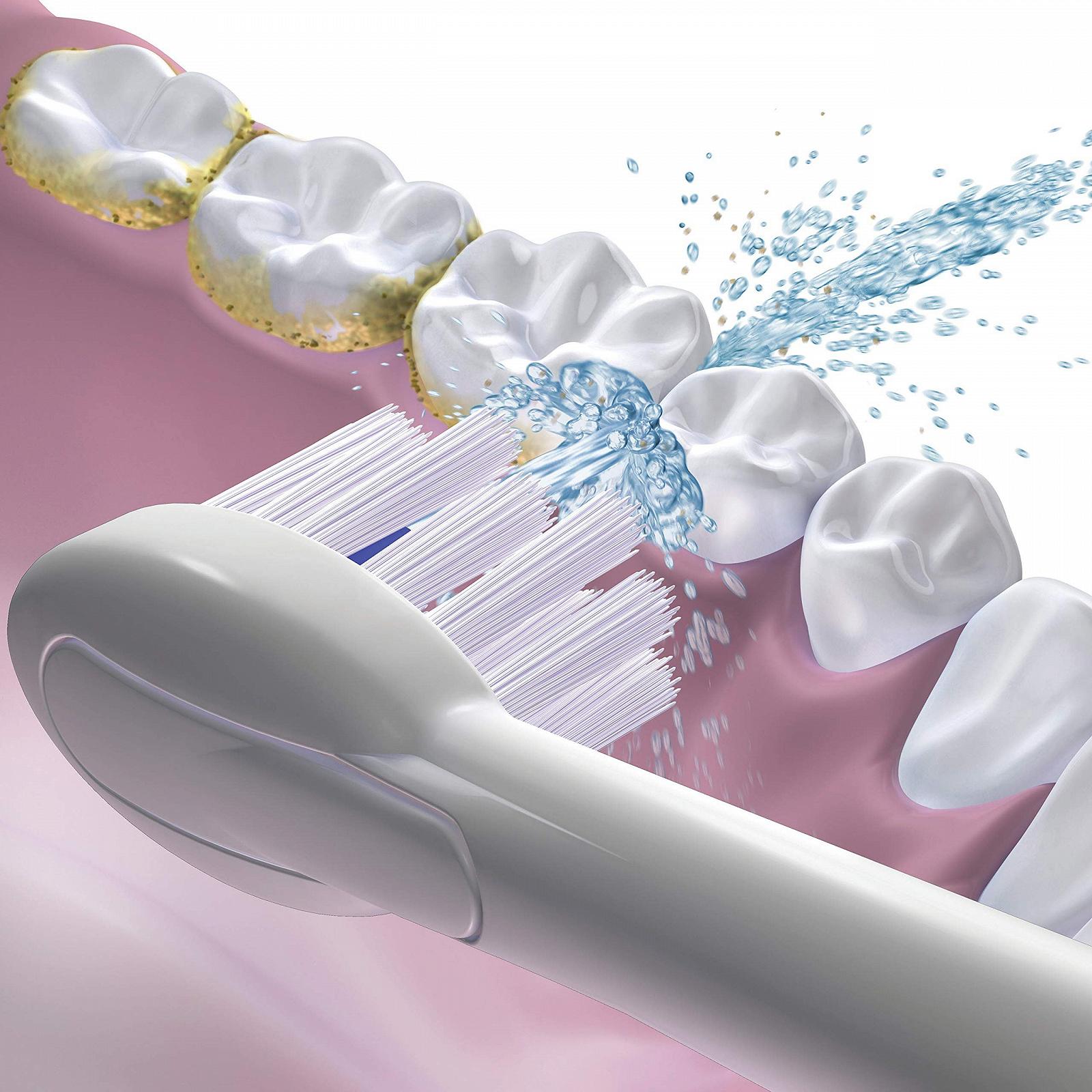 Насадки для зубной щетки Waterpik Sonic Fusion для электрической зубной щетки Sonic-Fusion с встроенным оральным ирригатором (2 шт. в упаковке), фото №3
