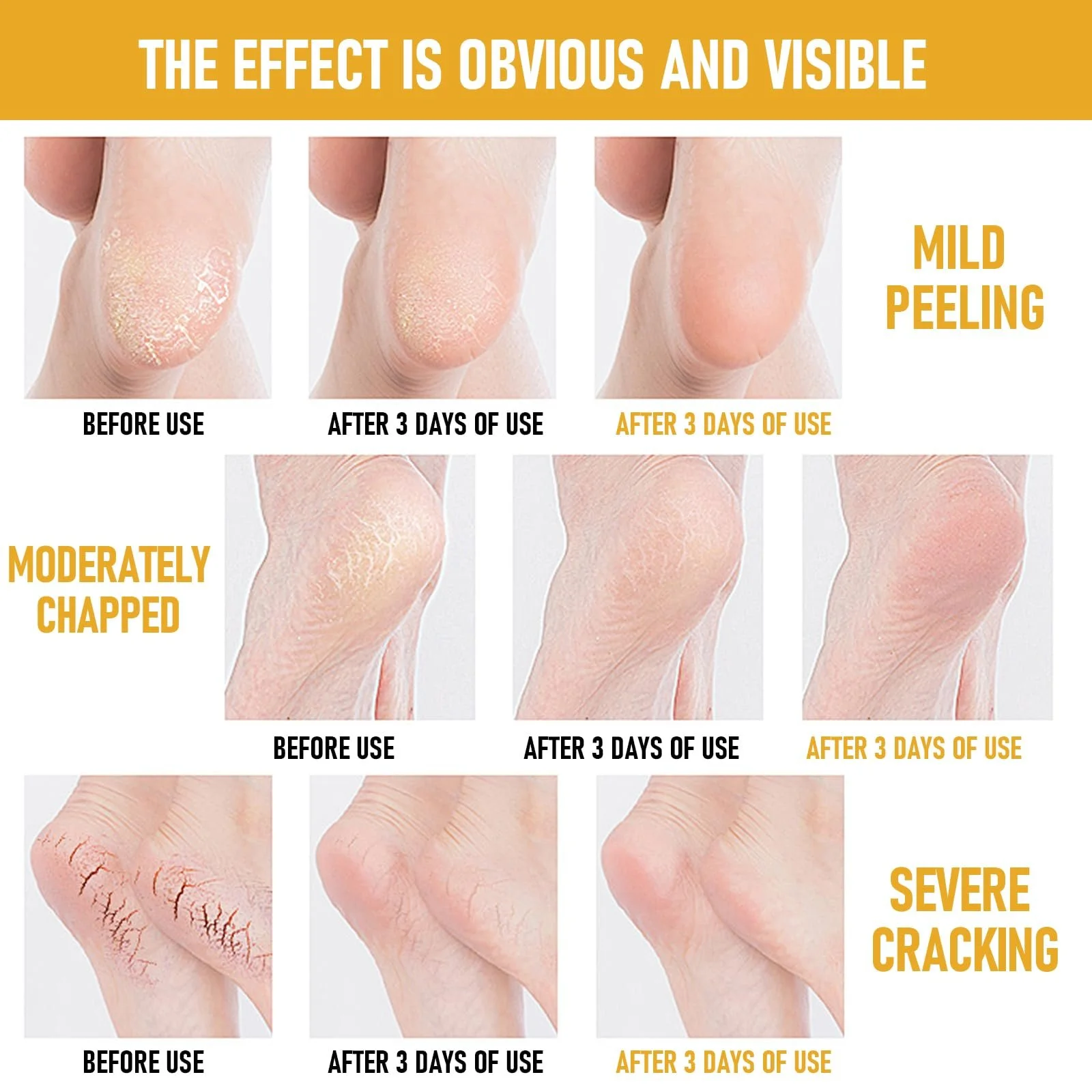 Крем-стик для ног Intensive Repair с маслом ши и кокоса 2 шт., фото №6