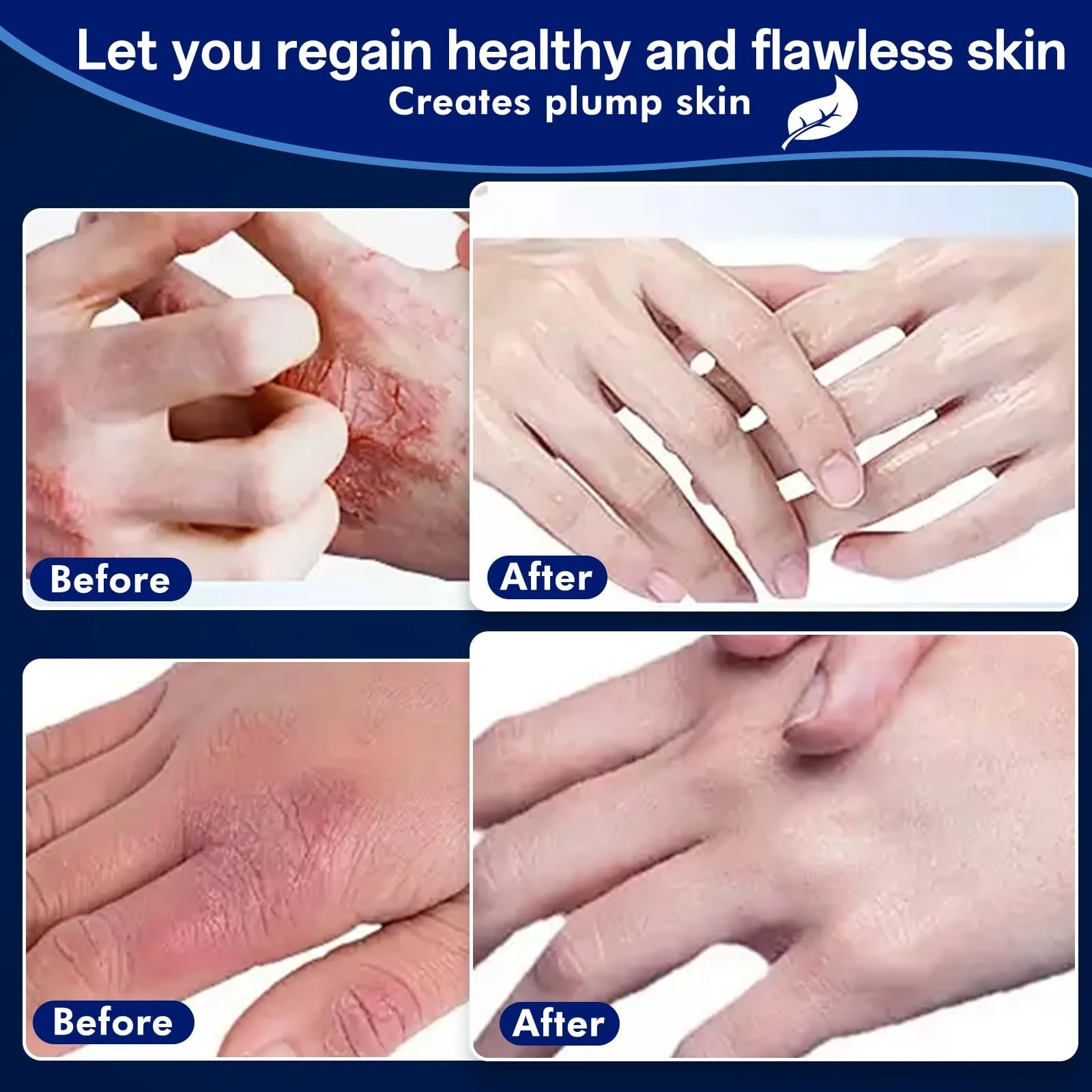 Крем протигрибковий Швидкої дії 20 г, фото №8