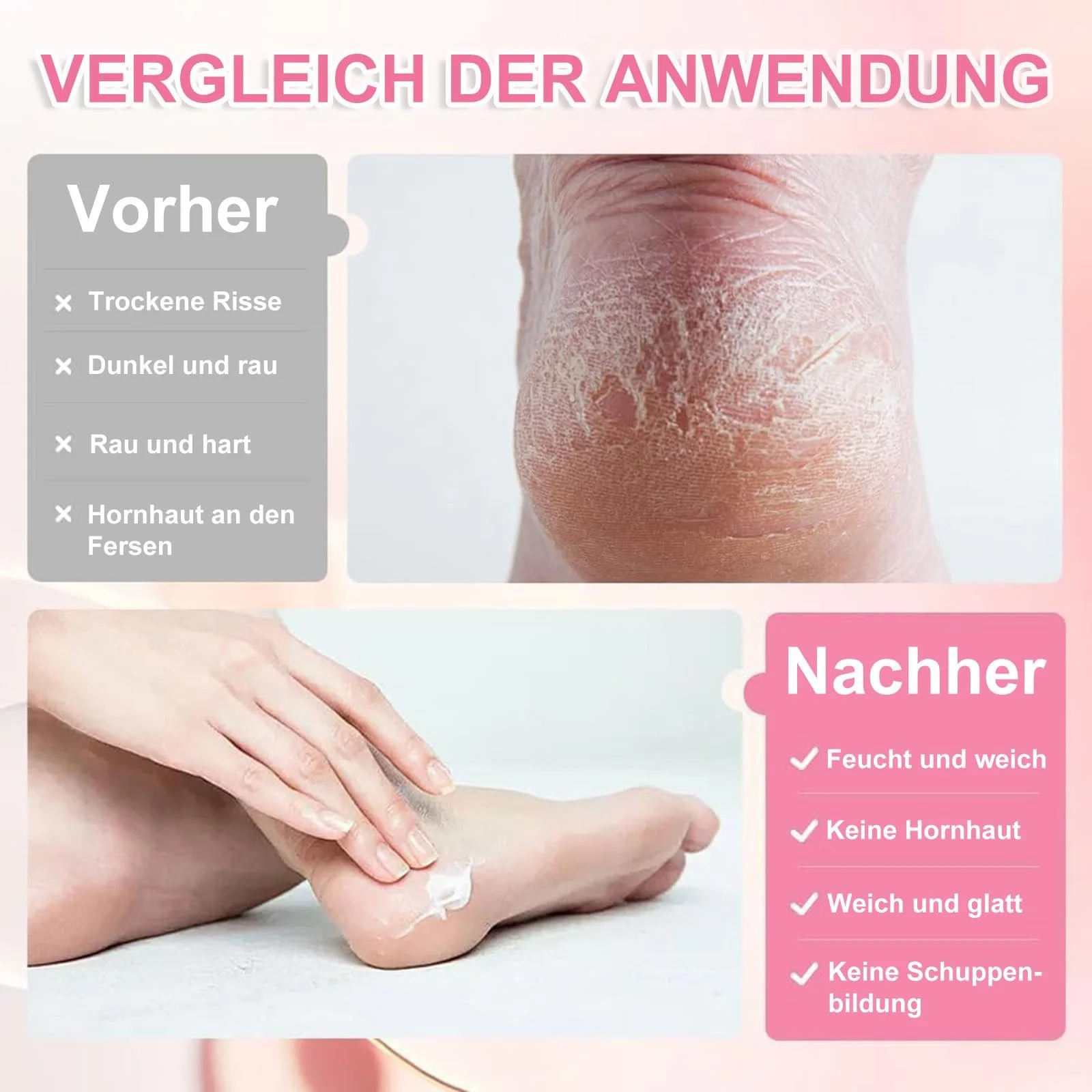 Крем для ног для очень сухой кожи от мозолей и трещин Набор 2 шт., фото №5