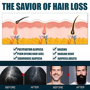 Сыворотка для роста волос Miioto, 180 мл, средство для роста волос, мужская, сыворотка для роста волос, уход за кожей головы, способствует утолщению волос, питает и предотвращает выпадение волос - Фото 1