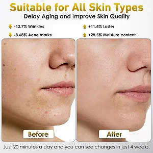 LED Маска для обличчя Ntyikul 7 кольорів світла, 5 рівнів яскравості, червоне світло, з пультом дистанційного керування synthetic.ua - Фото 1