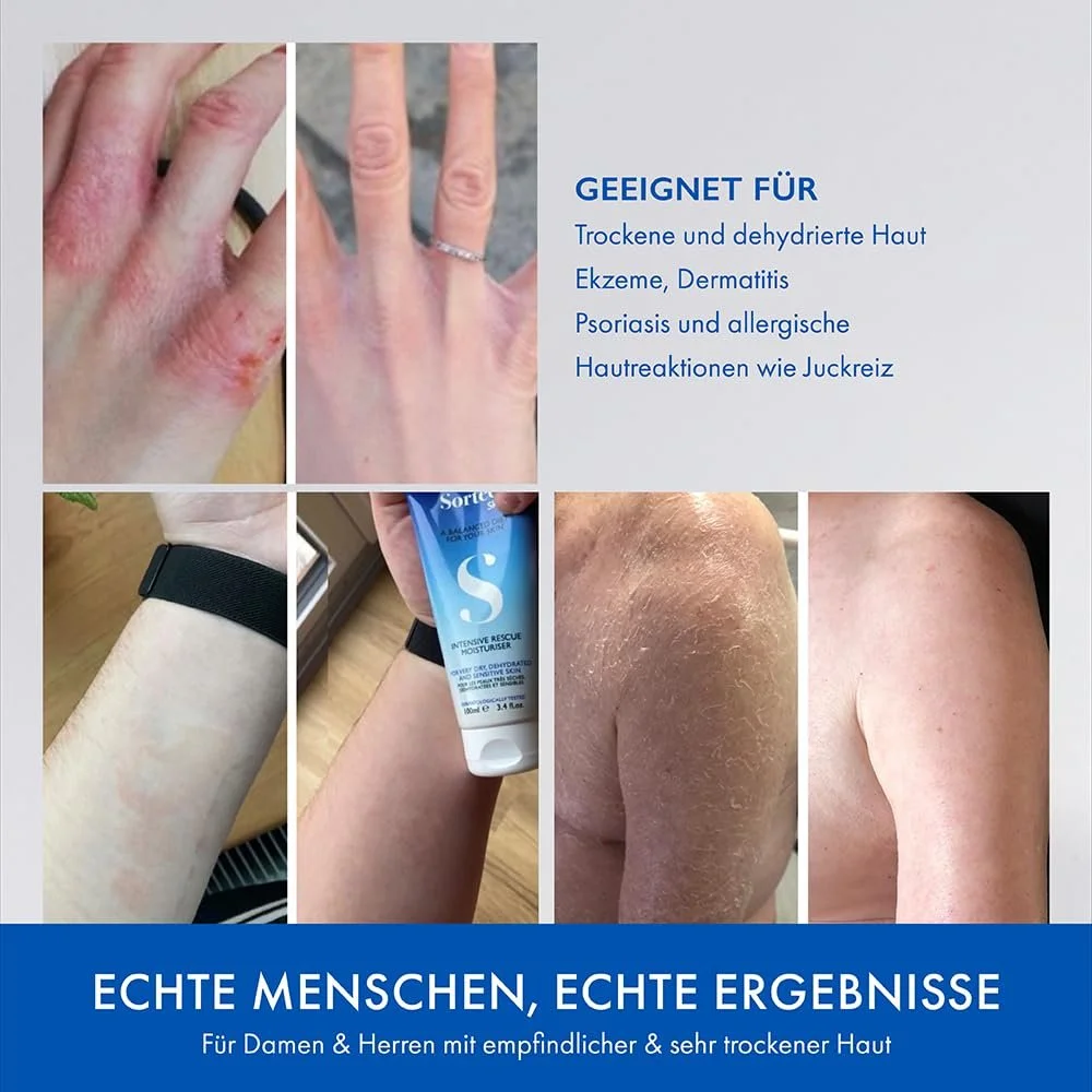 Лосьйон для тіла Sorted Skin Intensive Rescue для дуже сухої та чутливої шкіри - 100 мл, фото №5