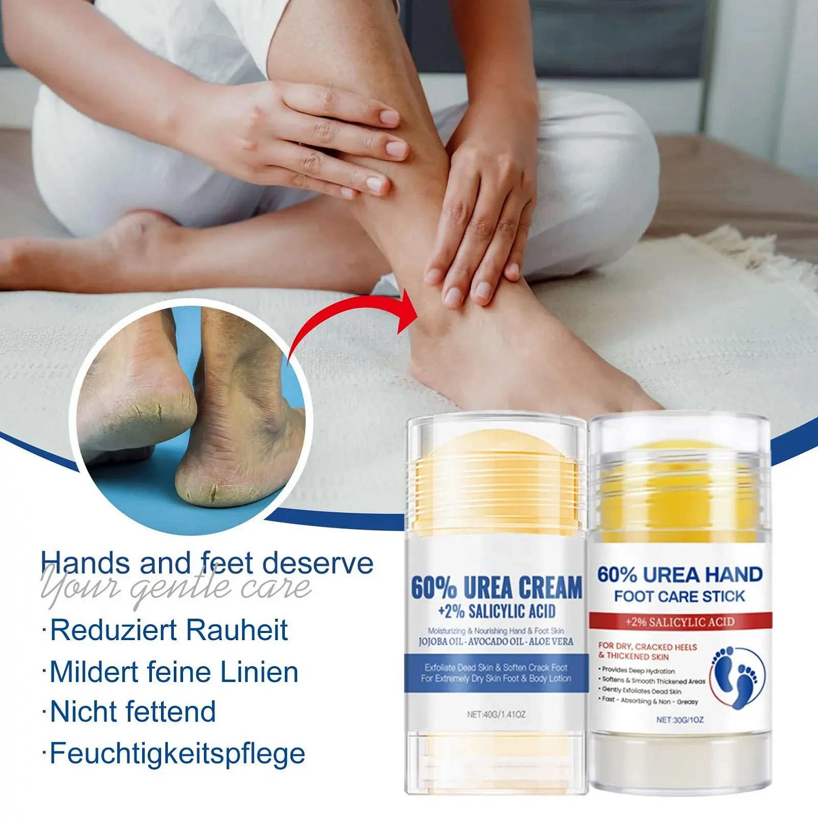 Крем для ног с мочевиной 60% 2 упаковки, фото №2