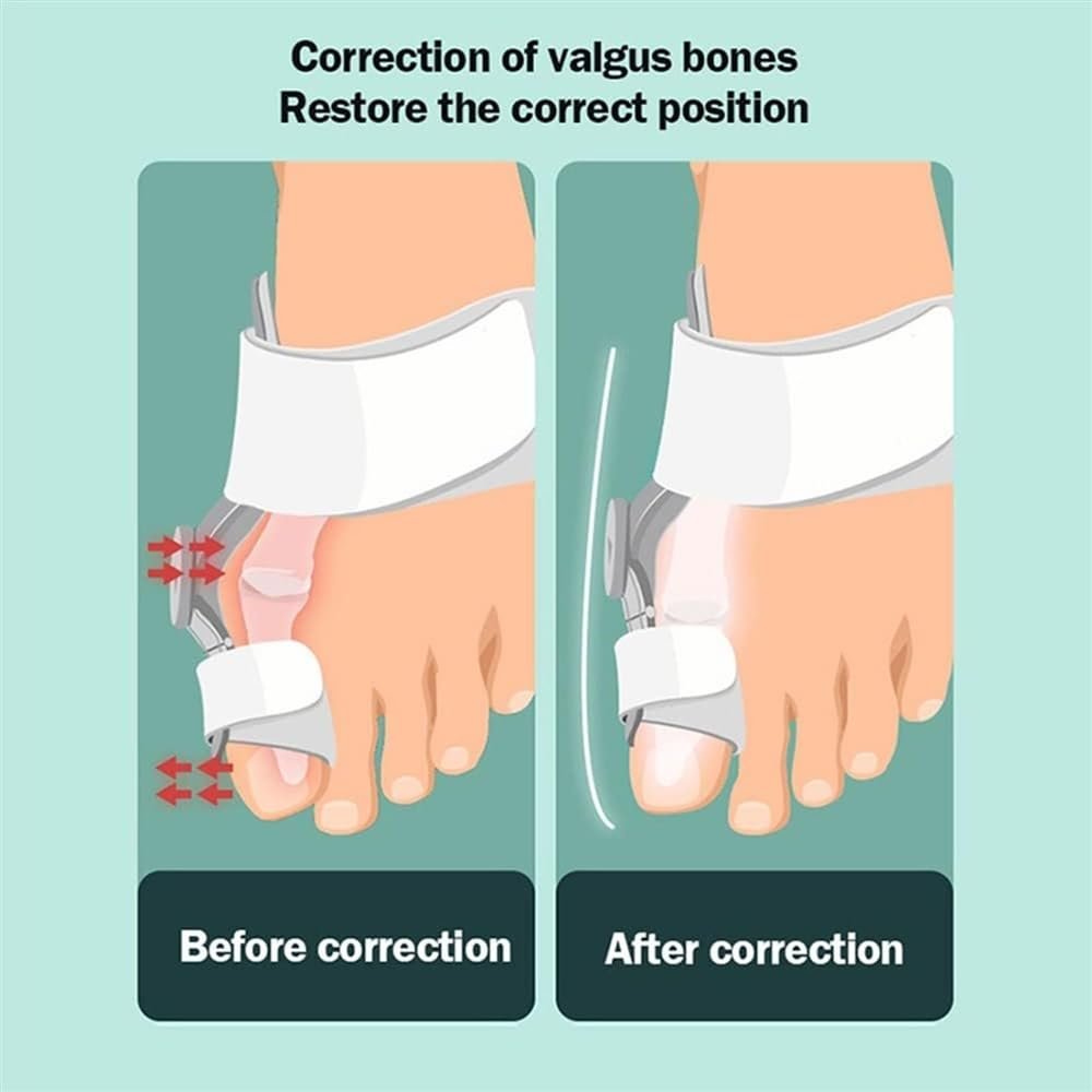 Выпрямитель большого пальца ноги, Бурситная ортеза, Регулируемая, фото №6