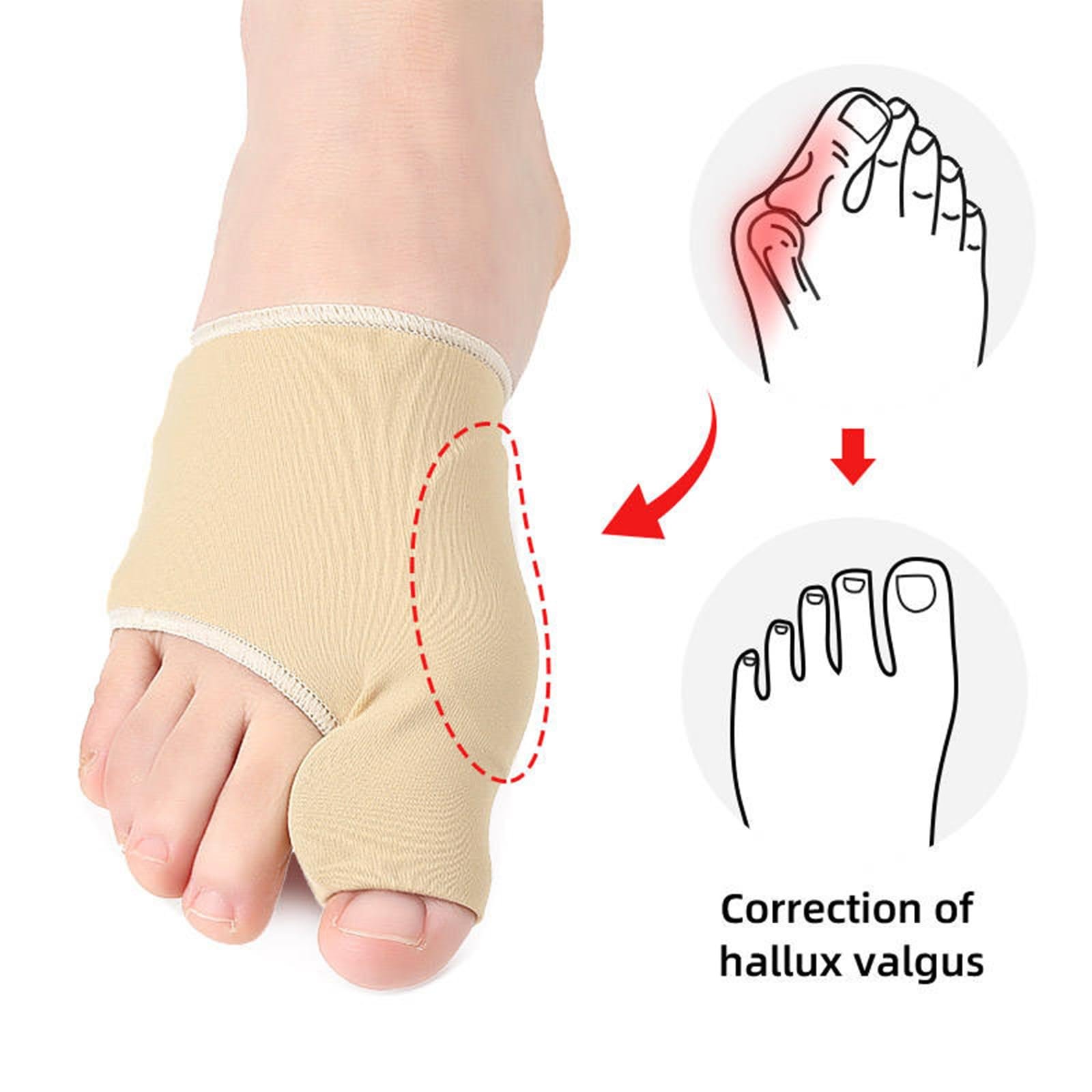 Шина для великого пальця стопи (Hallux Valgus) 1 пара, Коректор, фото №5
