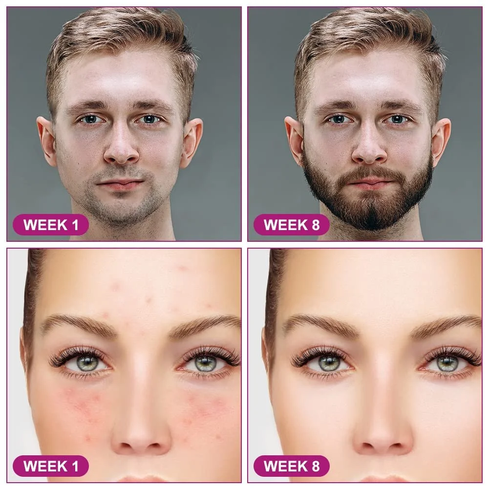 Ролер Derma LOPHE 6-в-1 Мікроголковий для тіла та обличчя для догляду за шкірою, фото №7