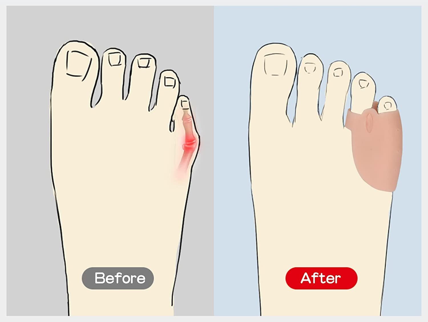 Роздільник для пальців ніг Силіконовий Маленький Рожевий (4 пари), фото №4 Роздільник для пальців ніг Силіконовий Маленький Рожевий (4 пари), фото №4