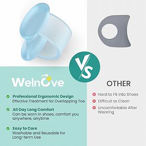 Роздільник для пальців ніг Welnove, Коректор для вальгусної деформації великого пальця стопи для жінок synthetic.ua - Фото 1