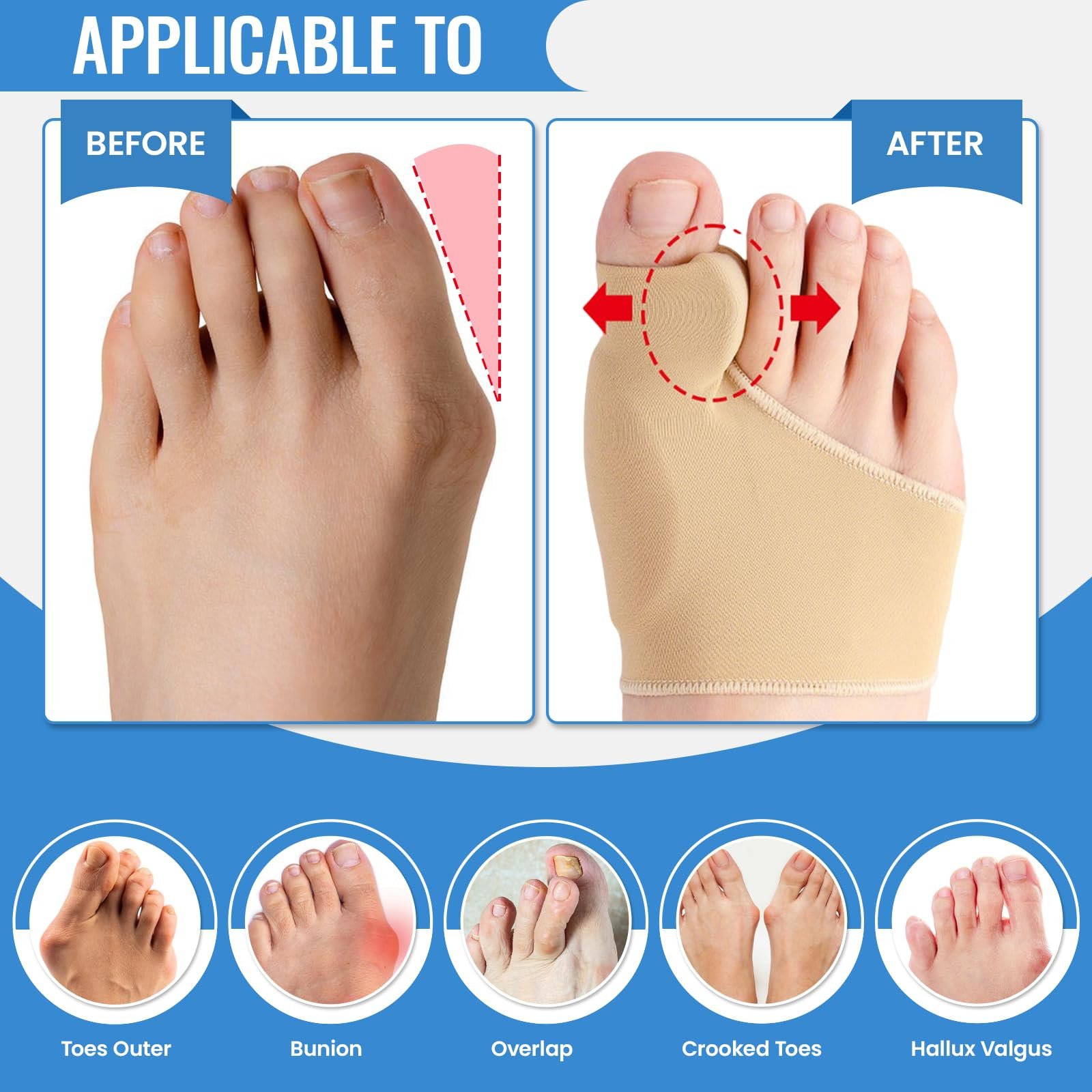 Шкарпетки для корекції Hallux Valgus, 1 пара, M (37-43), бандаж з силіконовими подушечками, фото №2