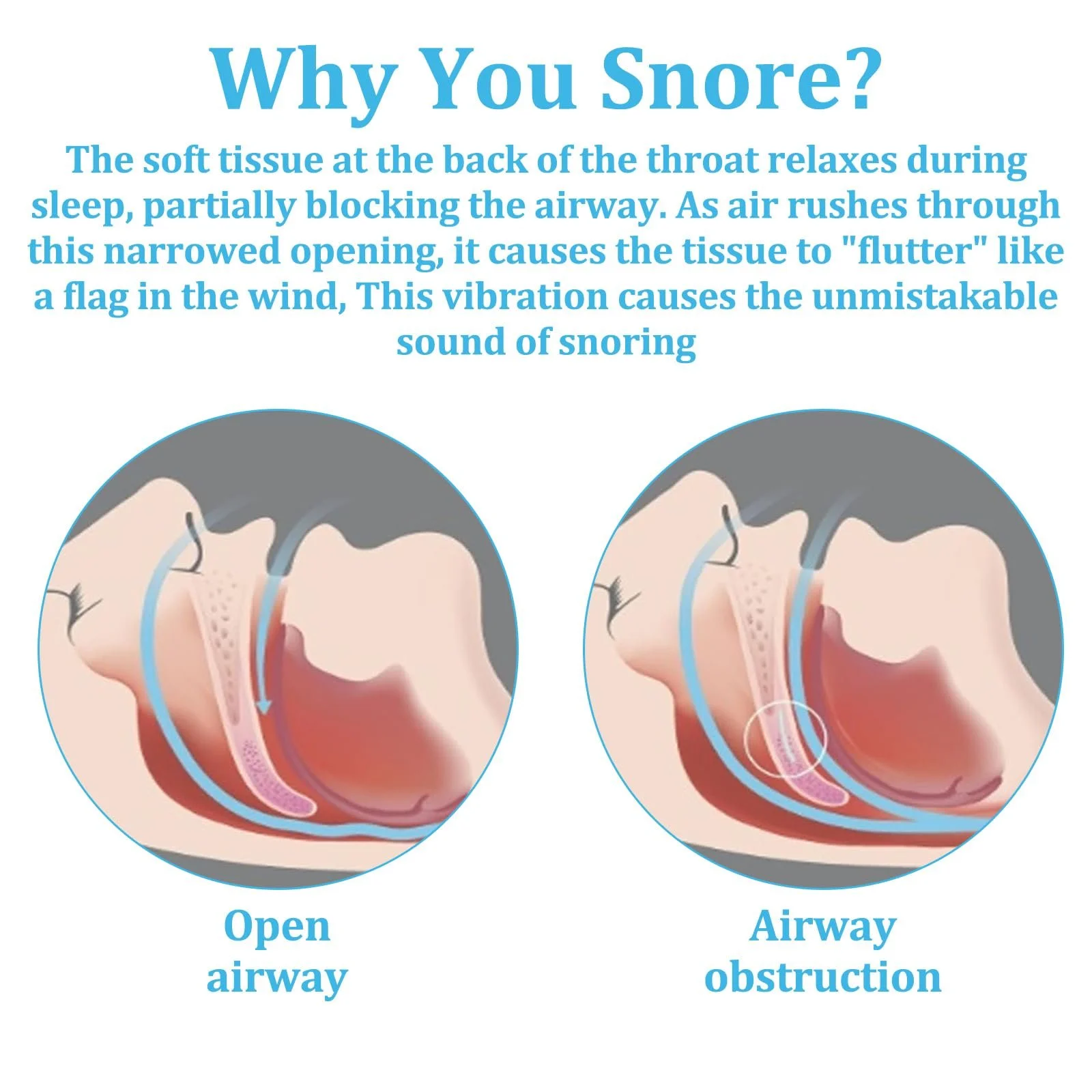 Капа от храпа (2 шт.) Comfort для мужчин и женщин, белая, голубая, фото №4