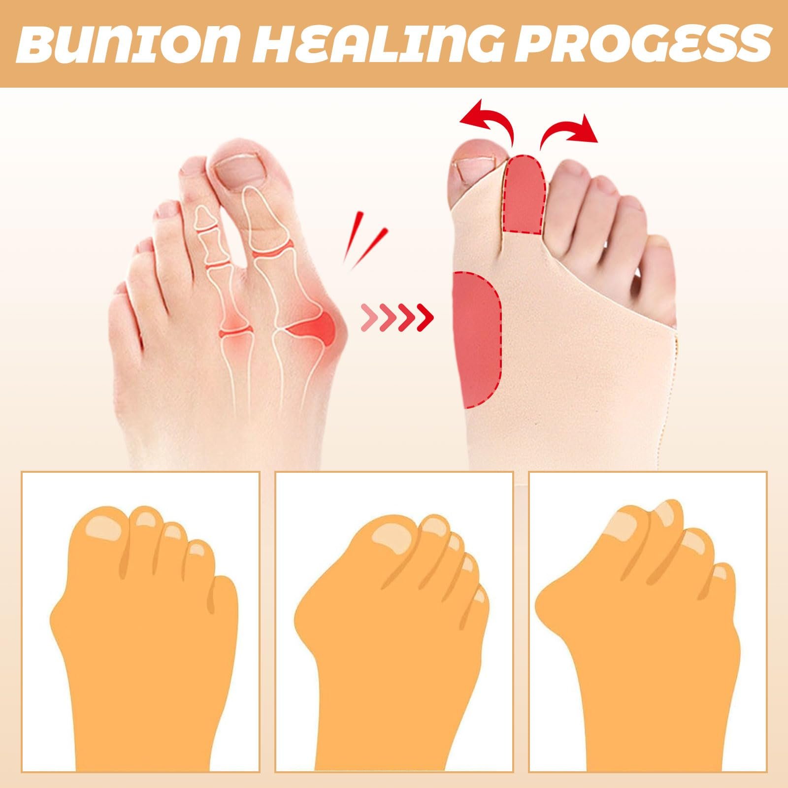 Пов'язка для корекції Hallux Valgus Lankai, Hallux, Роздільник для пальців ніг, фото №4