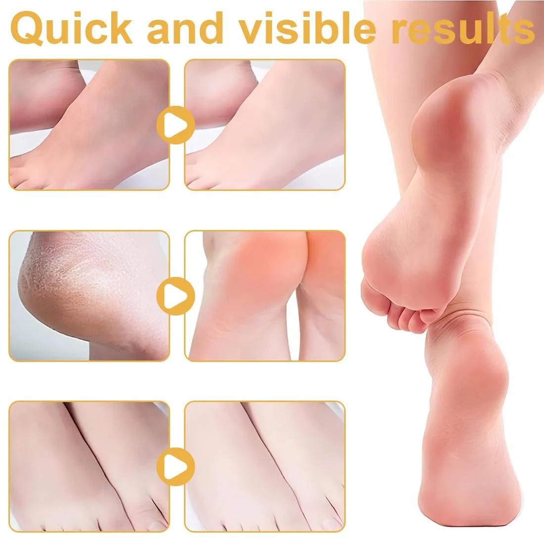 Крем для рук и ног Urea 60% увлажняющий набор 2 шт, фото №4 Крем для рук и ног Urea 60% увлажняющий набор 2 шт, фото №4