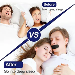 Полоски для рта Forhome, 100 шт., пластырь от храпа, для сна. synthetic.ua - Фото 1