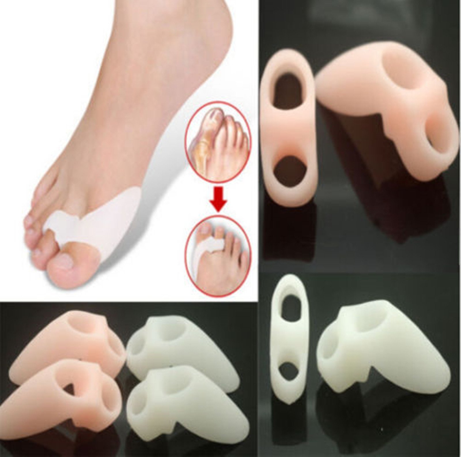 Гелевая шина для коррекции вальгусной деформации CareforYou 2 x, фото №4 Гелевая шина для коррекции вальгусной деформации CareforYou 2 x, фото №4