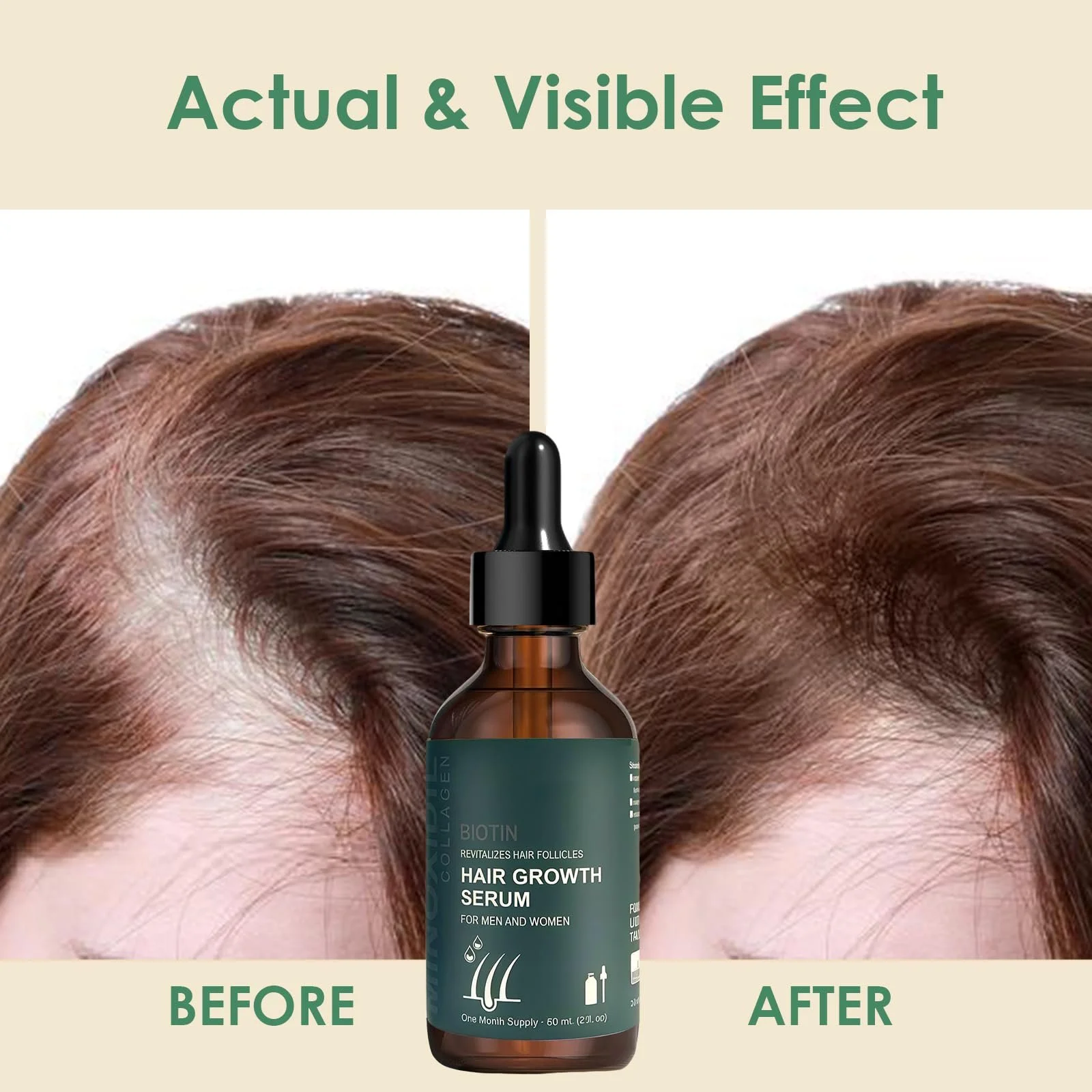Сироватка для росту волосся 60 мл для чоловіків і жінок, з ролером 0,5 мм, Засіб для догляду за волоссям, фото №5