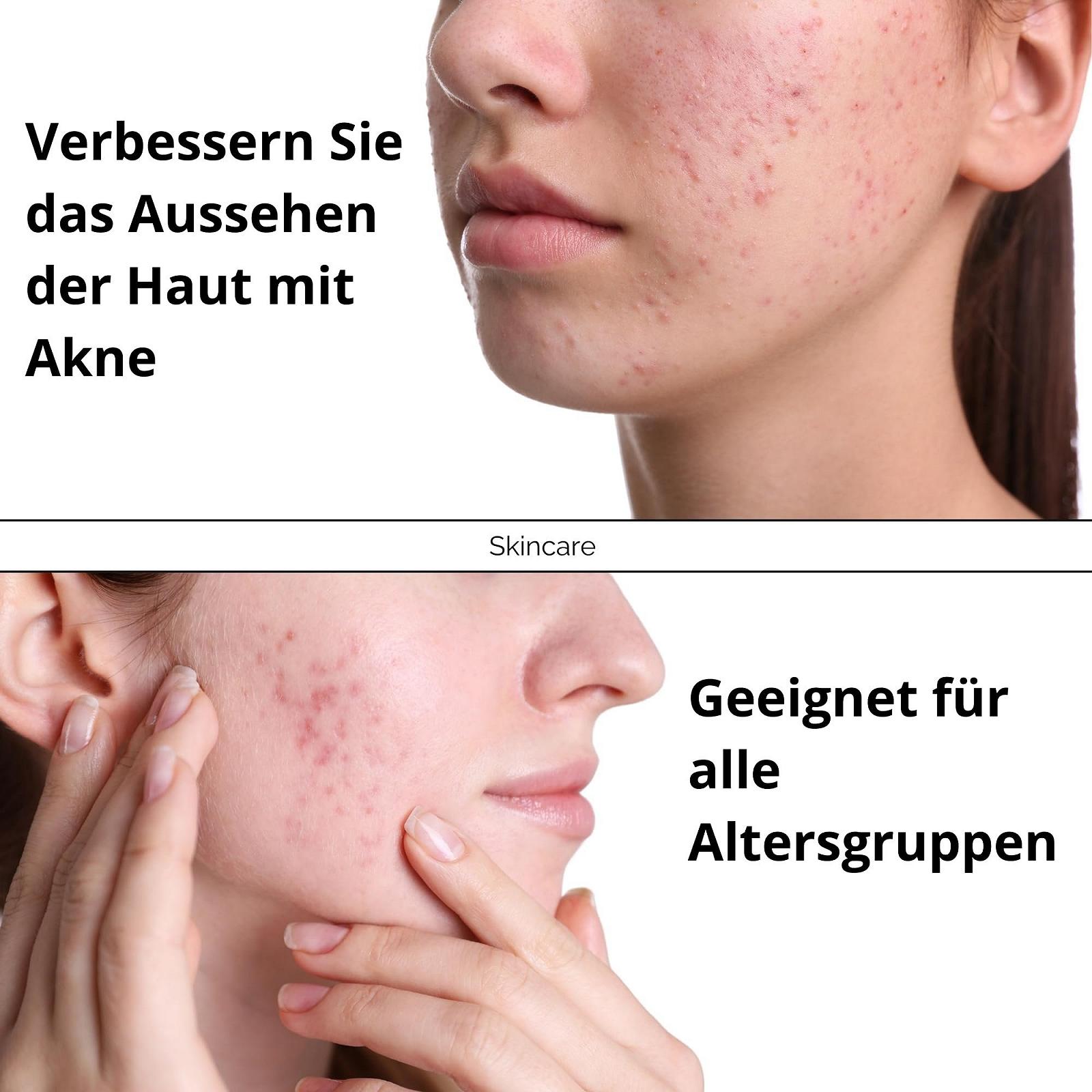 Гель-маска з активованим вугіллям KFS PROFESSIONAL з гіалуроновою кислотою 100 мл, фото №7