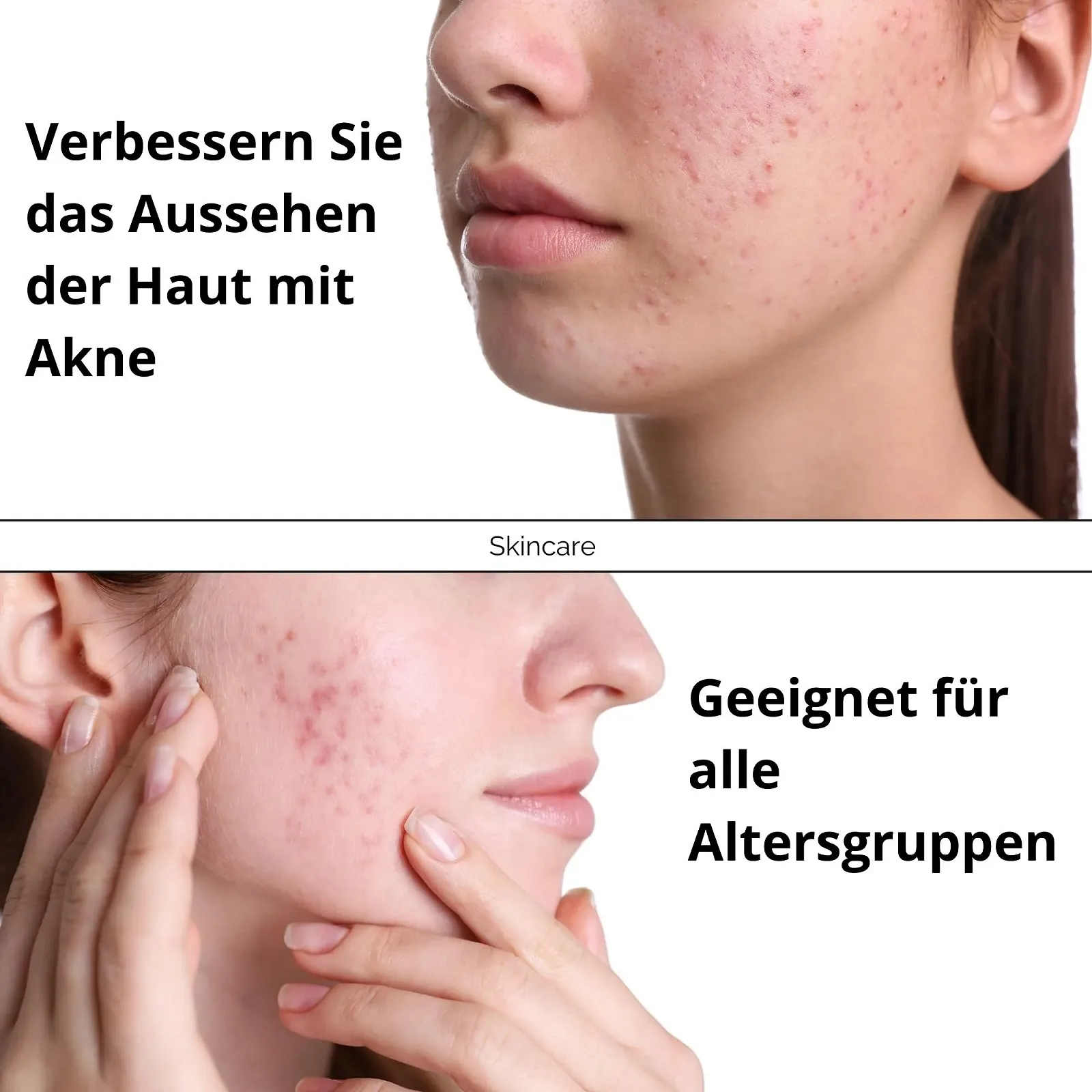 Гель-маска с активированным углем KFS PROFESSIONAL с гиалуроновой кислотой 100 мл, фото №7