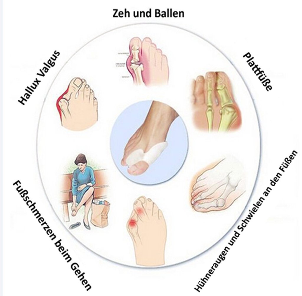 Роздільник для пальців ніг Силіконовий гель (SEBS) для жінок чоловіків дітей 4 шт, фото №4 Роздільник для пальців ніг Силіконовий гель (SEBS) для жінок чоловіків дітей 4 шт, фото №4