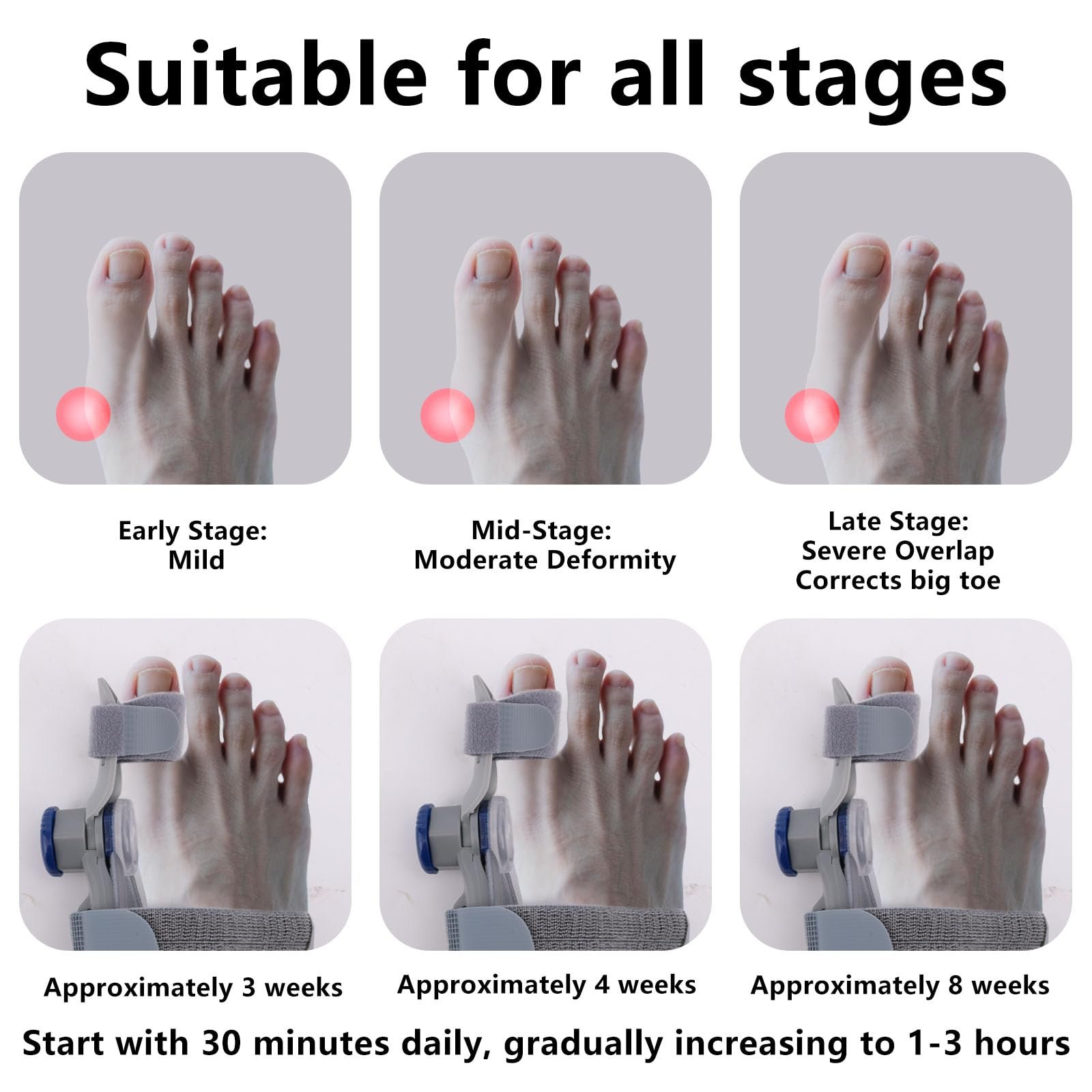 Коректор великого пальця стопи Регульований, фото №6