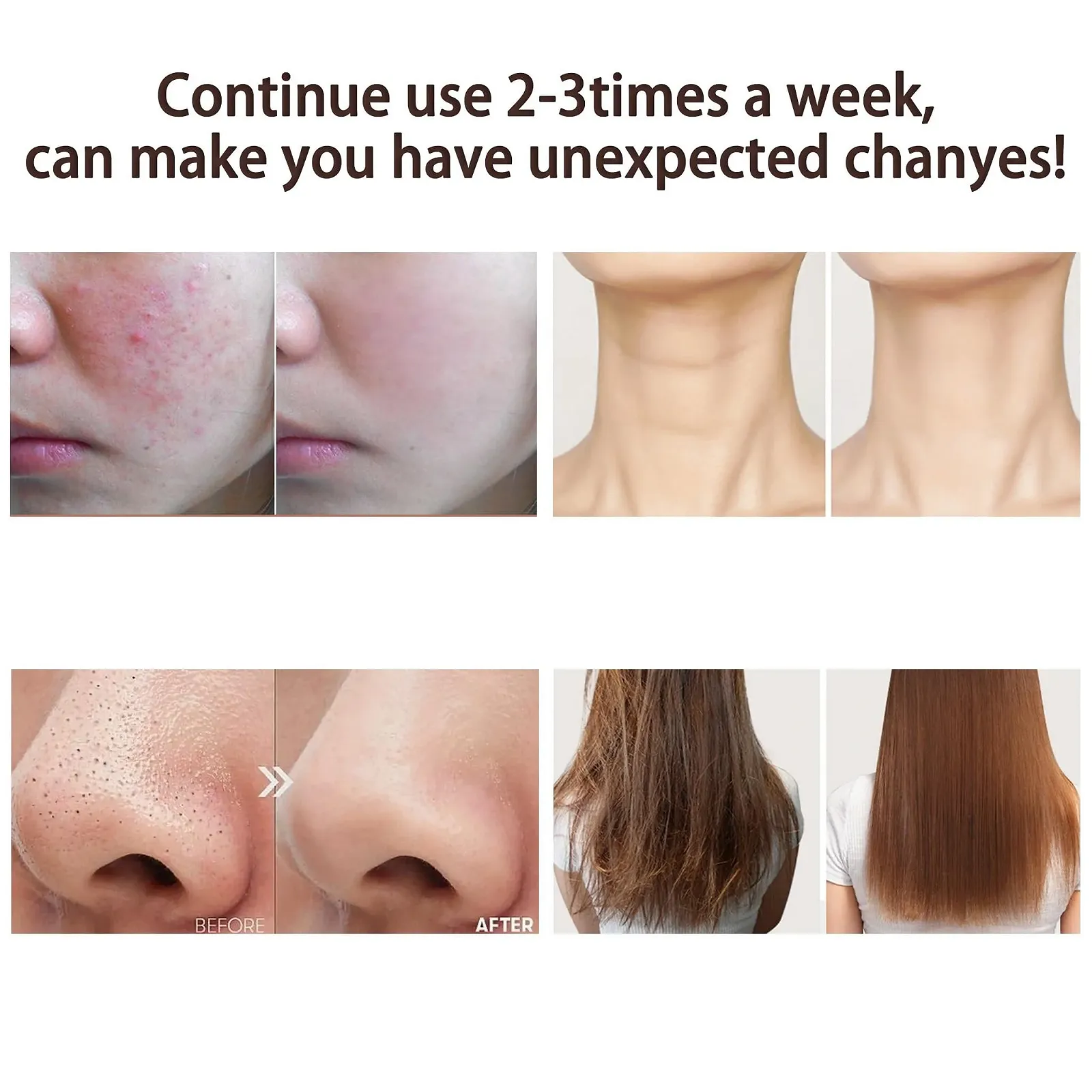 Апарат Дарсонваль High Frequency Stick 6 насадок Neon/Argon, фото №3