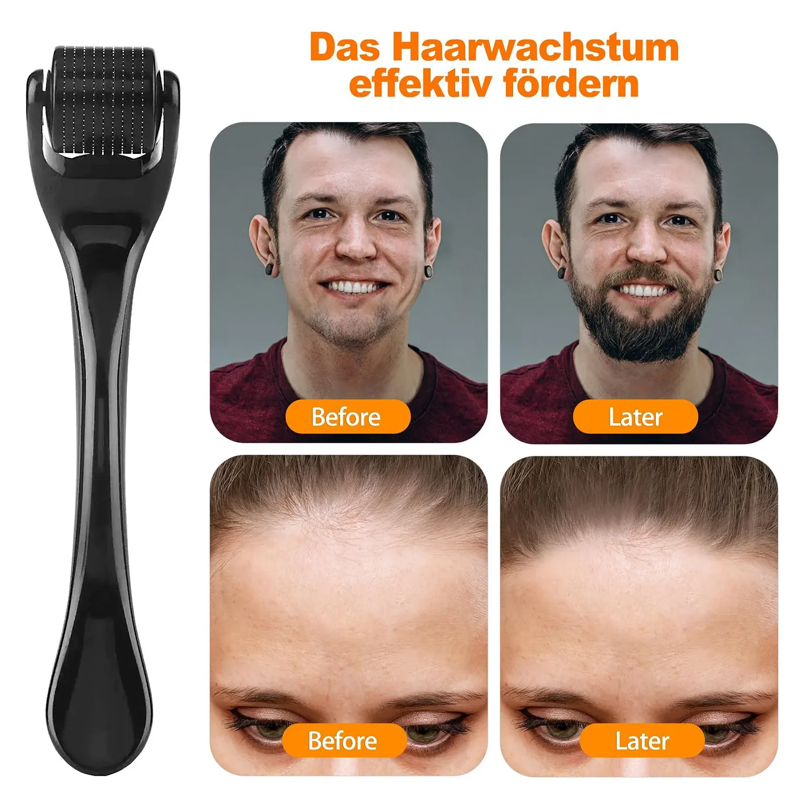 Дермаролер OioTuyi 0,5 мм для бороди та волосся, мікроголковий ролик, фото №2