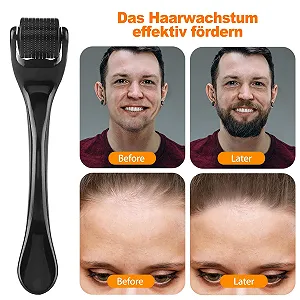 Дермаролер OioTuyi 0,5 мм для бороди та волосся, мікроголковий ролик synthetic.ua - Фото 1