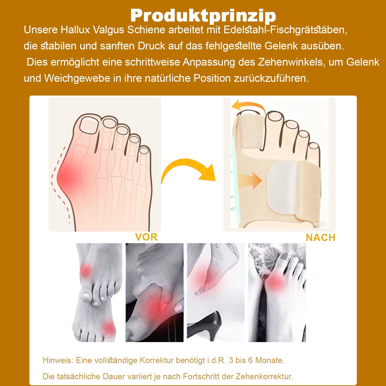 Шина Hallux Valgus Correction 2025 для корекції вальгусної деформації, 4 металеві скоби, денна та нічна, унісекс, розмір 35-42, 2 шт., фото №2