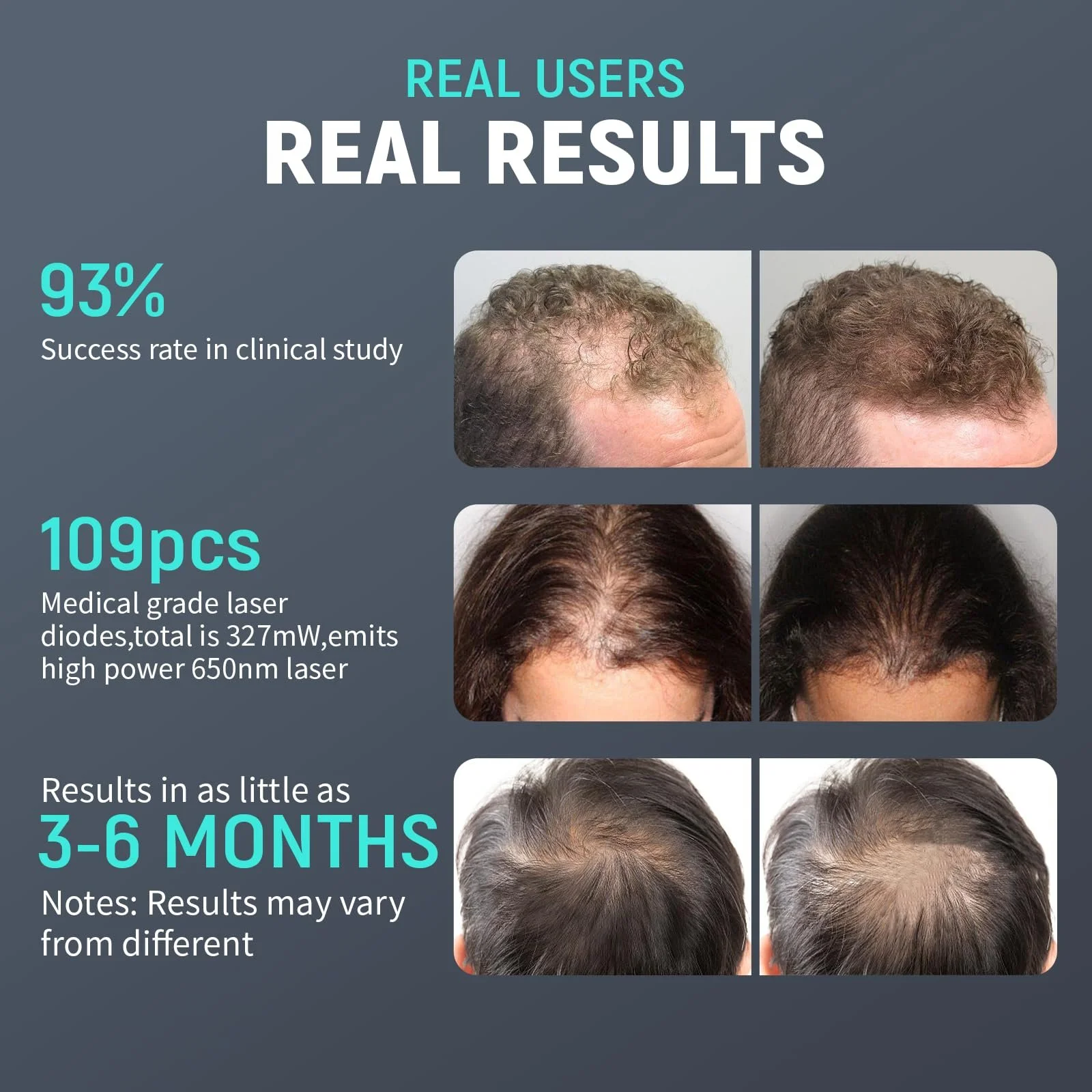 Шлем лазерний LLLT для росту волосся при випадінні волосся, фото №2