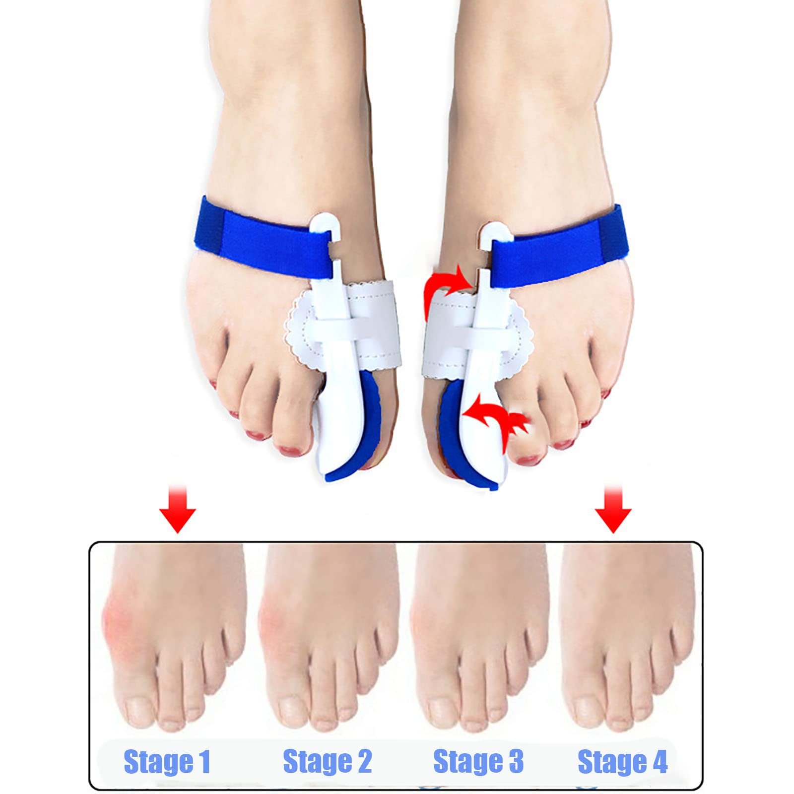 Коректор Вальгусної Деформації для Жінок та Чоловіків Ортопедичний Синій, фото №4