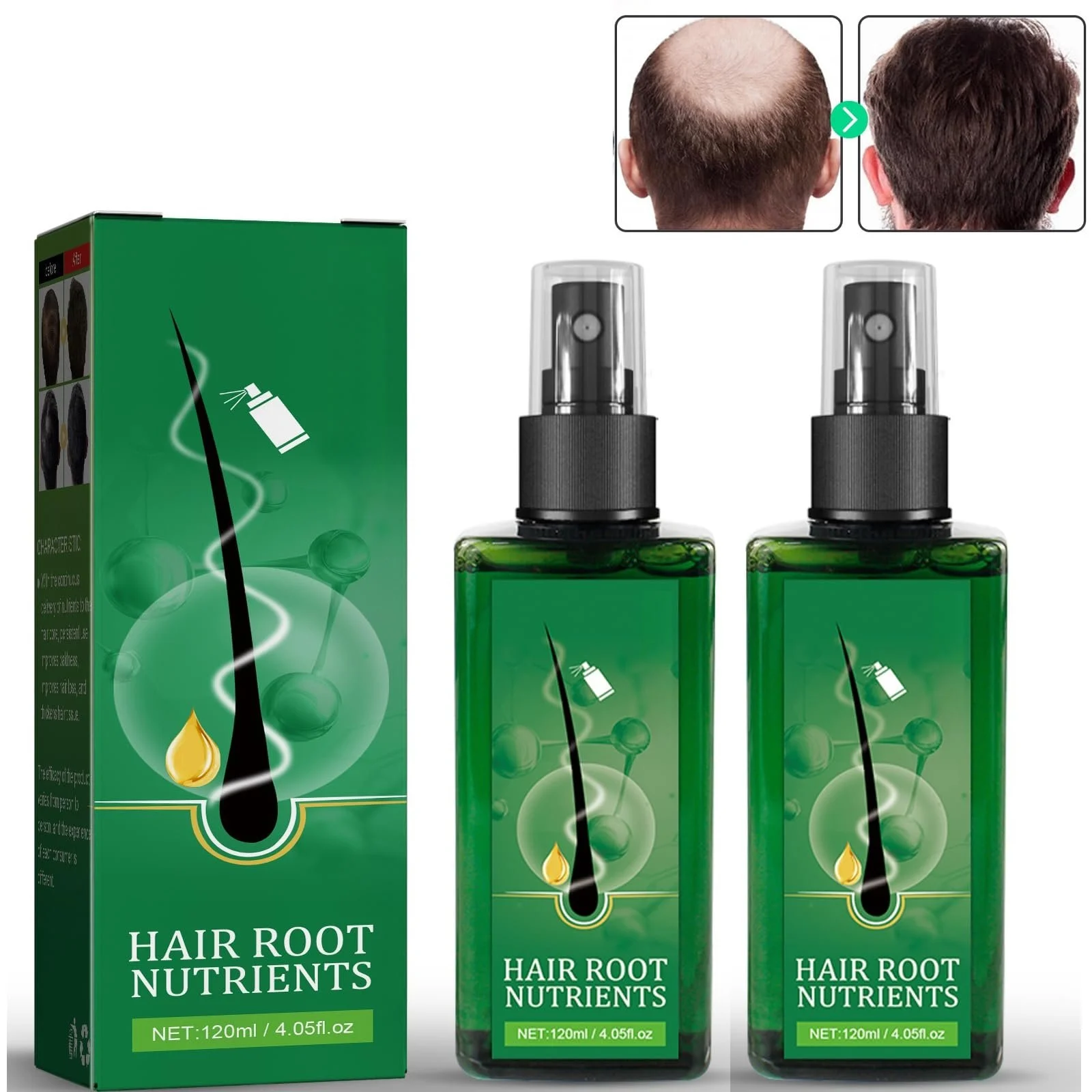 Сироватка для коренів волосся Tkekruh 120 мл, 2 шт., фото №1