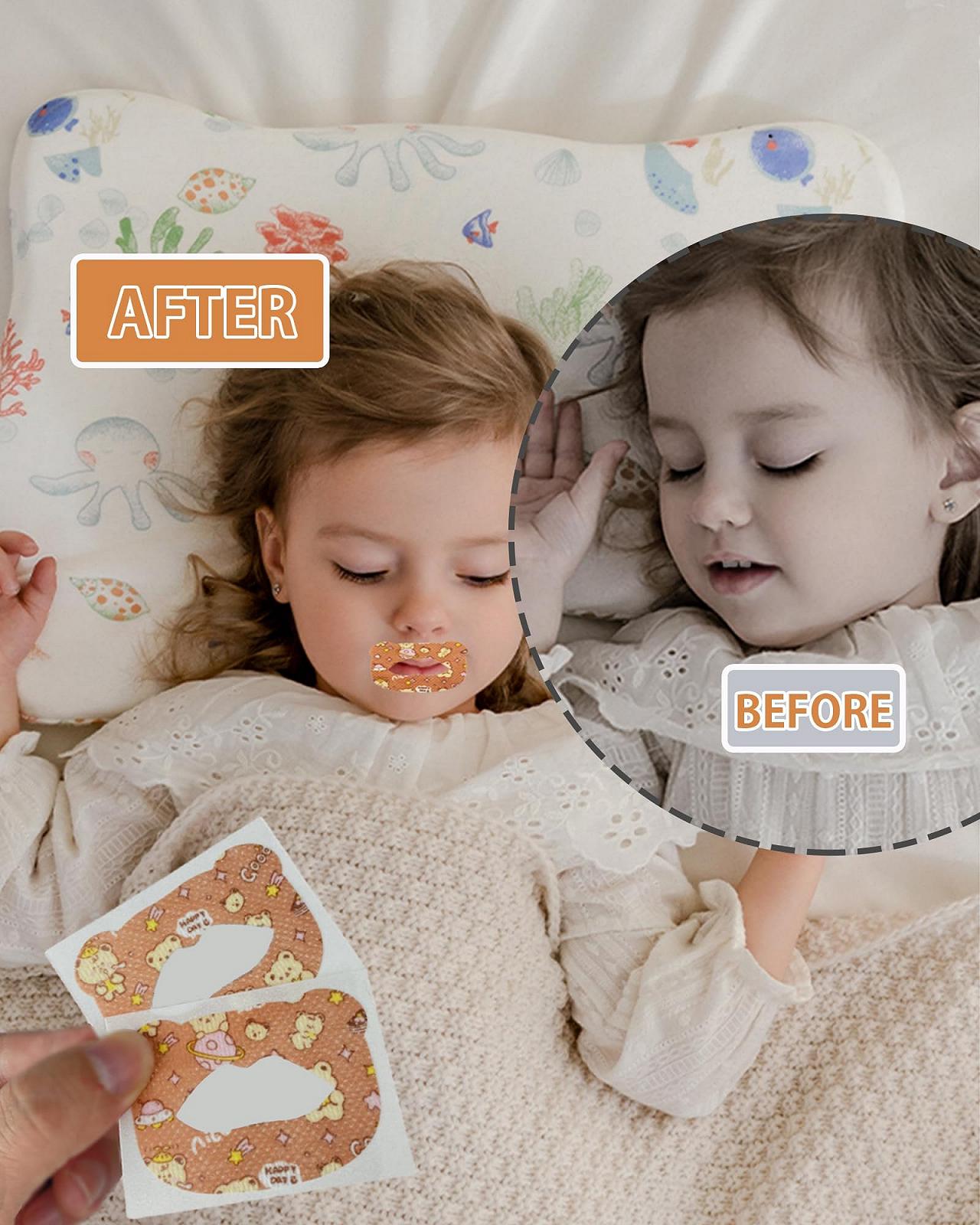 Смужка для сну на рот Сприяє диханню носом, зупиняє дихання ротом, фото №5