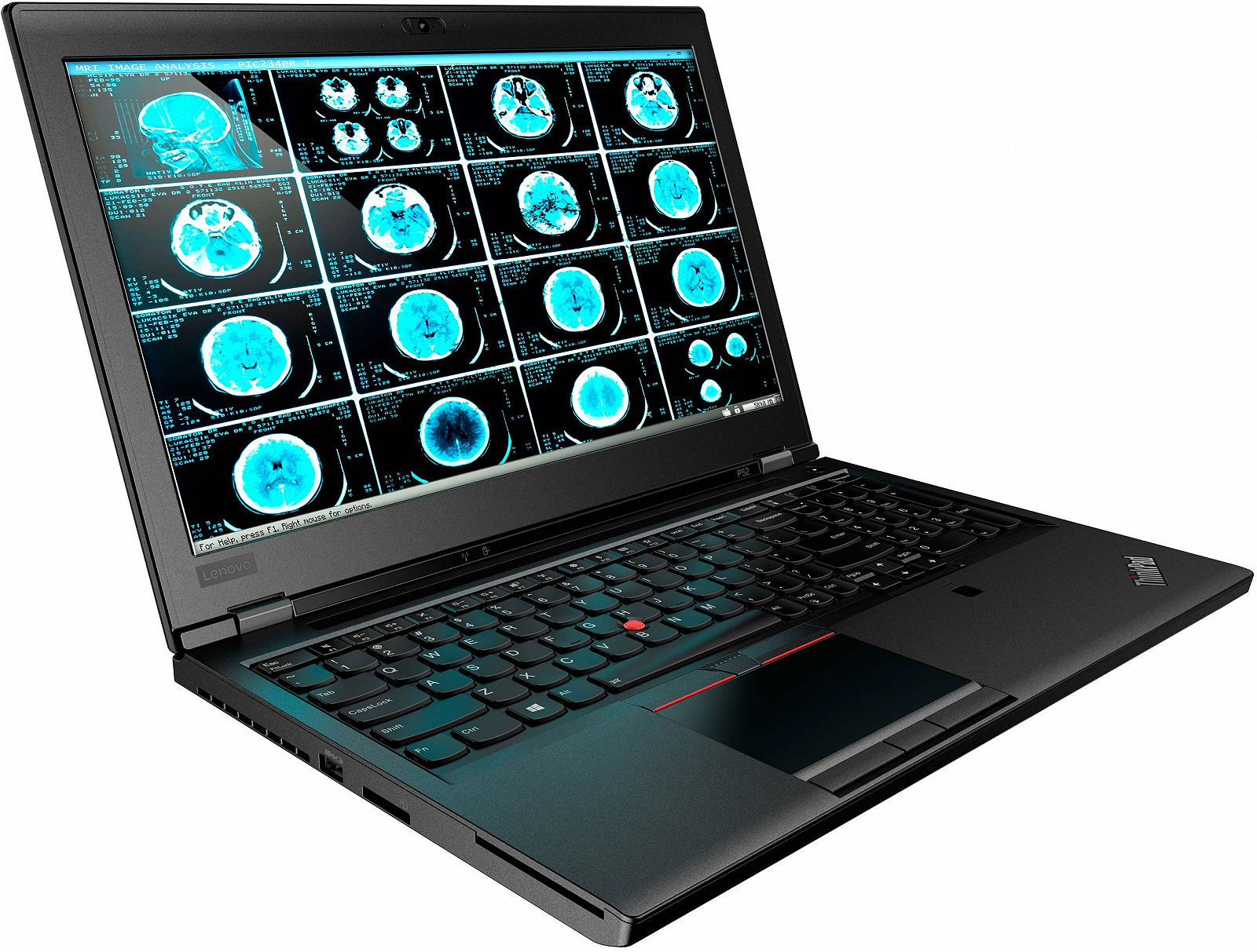 Ноутбук 15.6" Lenovo ThinkPad P52 Mobile Workstation Intel Core i7 RAM 16GB SSD 512GB Nvidia Quadro P1000 Win11 Магниево-алюминиевой сплав (UKR), фото №4 Ноутбук 15.6" Lenovo ThinkPad P52 Mobile Workstation Intel Core i7 RAM 16GB SSD 512GB Nvidia Quadro P1000 Win11 Магниево-алюминиевой сплав (UKR), фото №4
