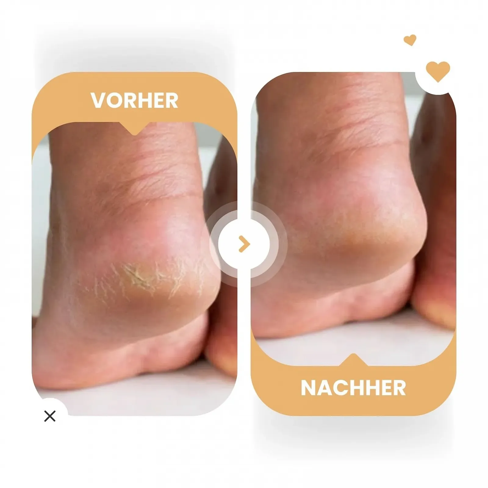 Крем для рук и ног 8% Набор для увлажнения и восстановления - Комбуча, гиалуроновая кислота и ниацинамид - для всех типов кожи - 2 x 100 г, фото №5