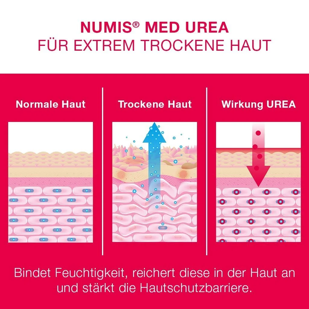 Крем для рук Numis Med з 10% сечовини - 2 шт. Крем для рук для дуже сухої та подразненої шкіри, фото №6