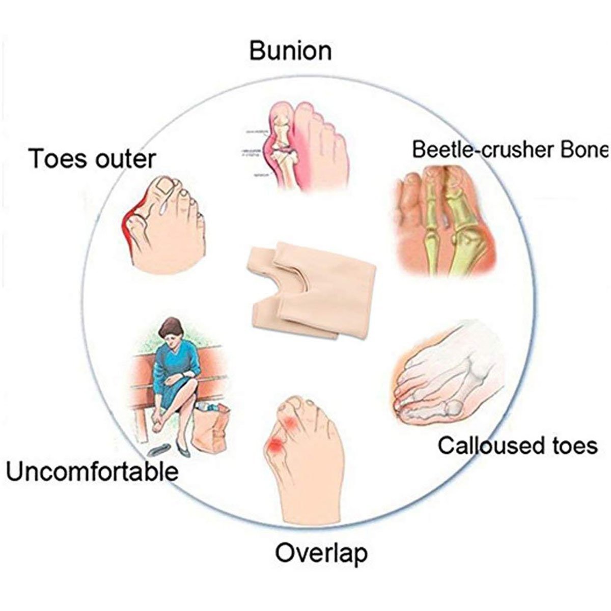Шкарпетки Pedimend для полегшення болю при вальгусній деформації великого пальця стопи, фото №2 Шкарпетки Pedimend для полегшення болю при вальгусній деформації великого пальця стопи, фото №2