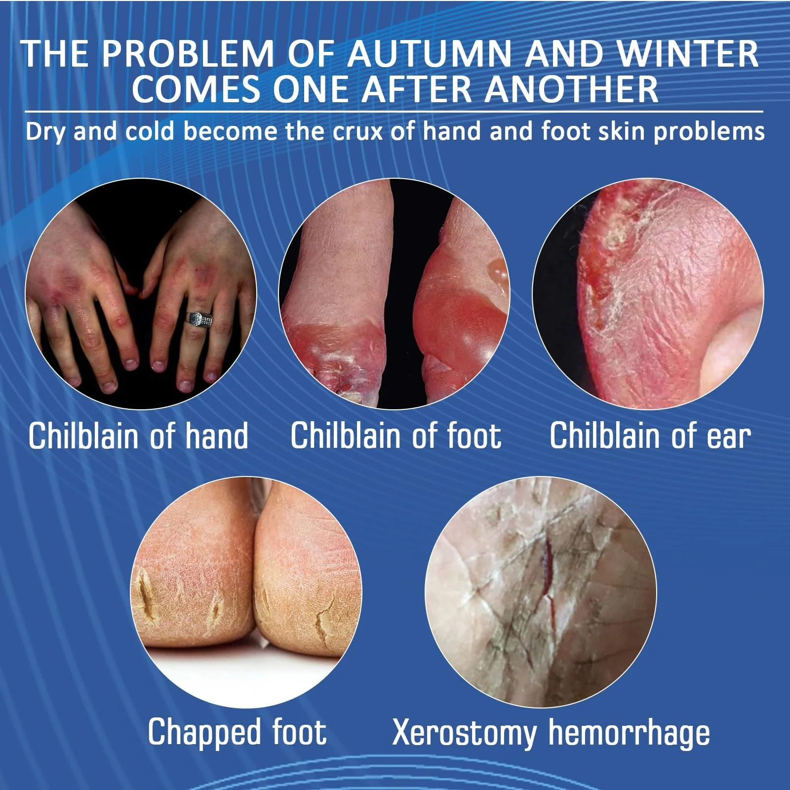 Восстанавливающий крем для ног и рук с гиалуроновой кислотой, 20 г, 1 шт., фото №3 Восстанавливающий крем для ног и рук с гиалуроновой кислотой, 20 г, 1 шт., фото №3