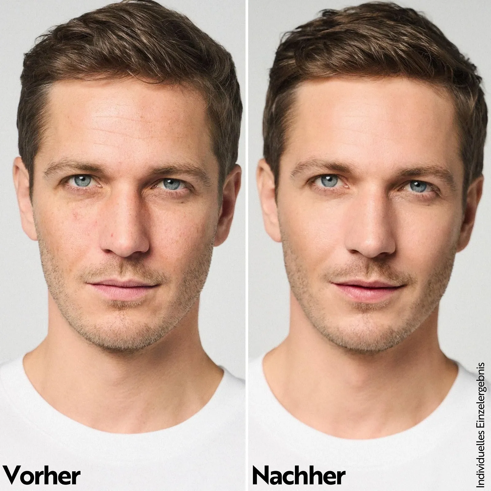 Гель для умывания M. Asam Aqua Intense Hyaluronic, 200 мл Нежное очищение лица с увлажняющим эффектом, удаляет макияж и загрязнения, без отдушек, веганский, уход за кожей любого типа, фото №3 Гель для умывания M. Asam Aqua Intense Hyaluronic, 200 мл Нежное очищение лица с увлажняющим эффектом, удаляет макияж и загрязнения, без отдушек, веганский, уход за кожей любого типа, фото №3