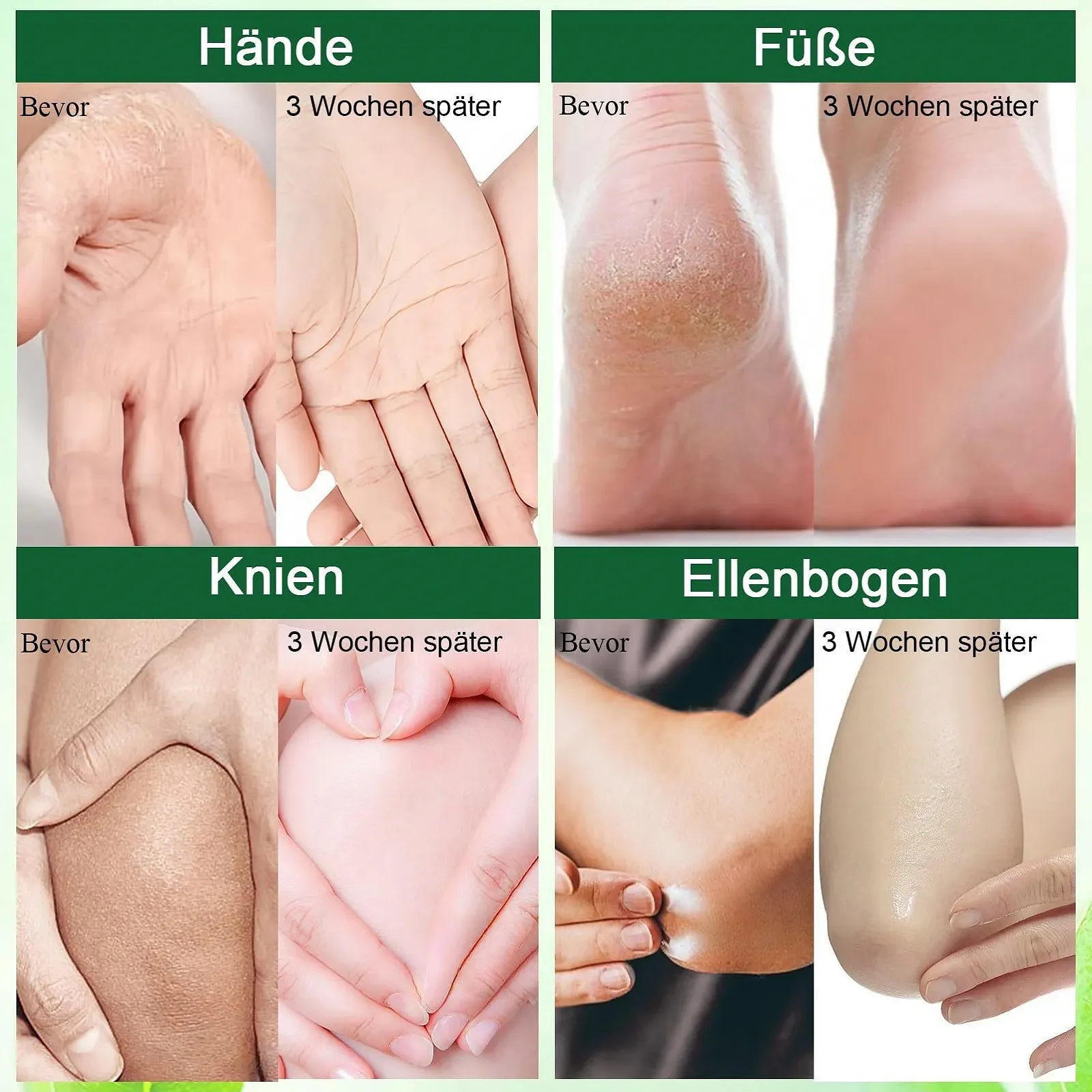 Крем для ног и рук Urea Cream 42% увлажняющий 100 г, фото №7