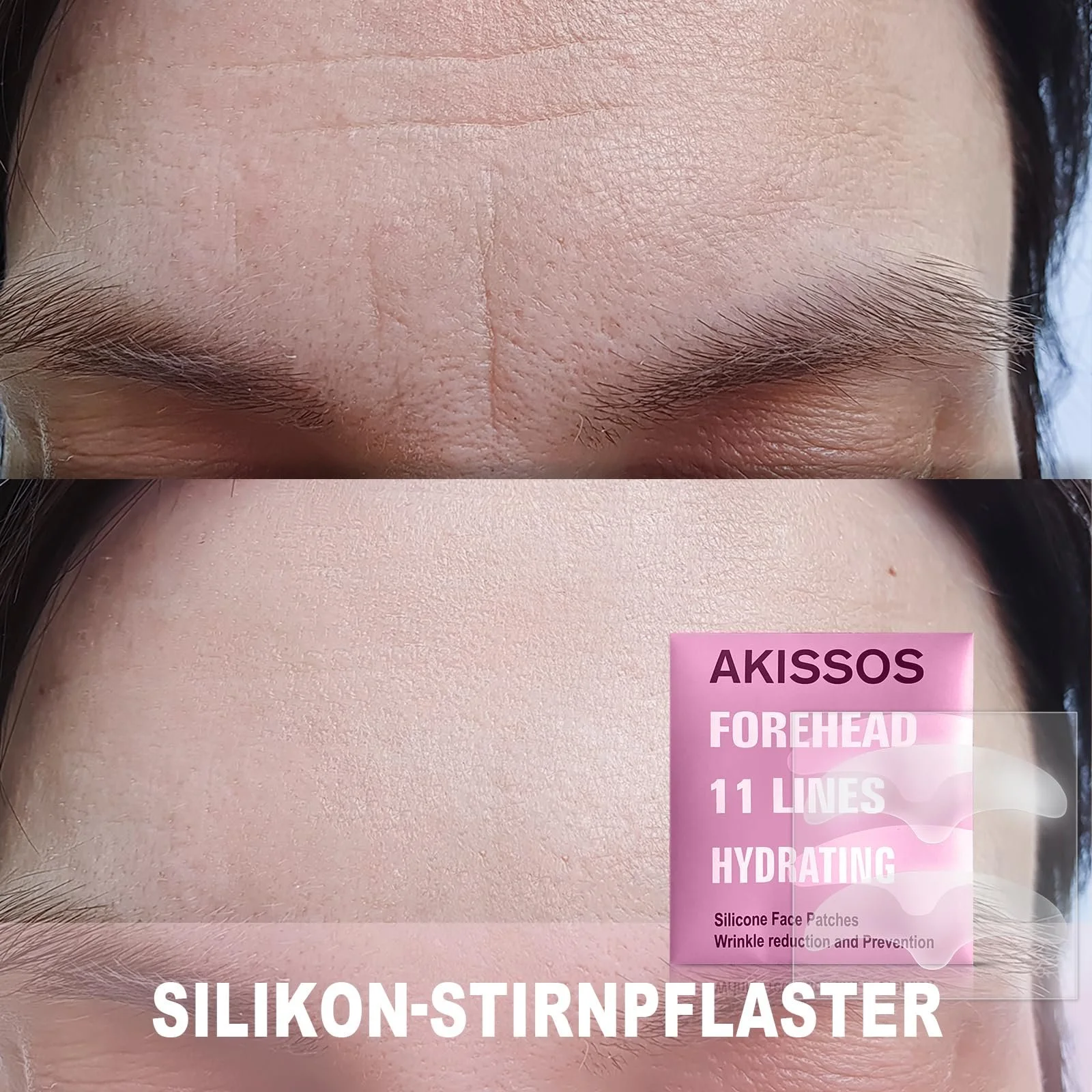 Силіконовий пластир Akissos проти зморшок для догляду за обличчям (лоб та міжбрівні зморшки), фото №8