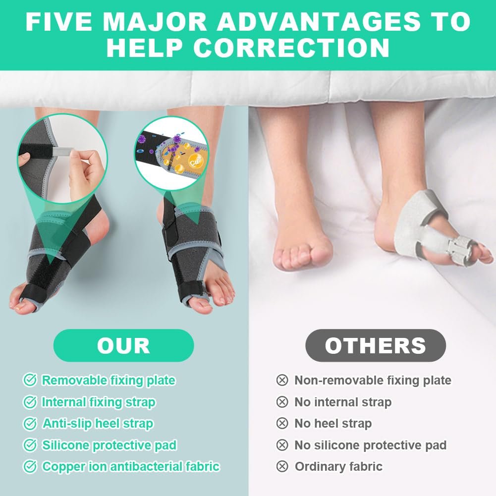 Шина для корекції Hallux Valgus Vicloon, фото №4 Шина для корекції Hallux Valgus Vicloon, фото №4