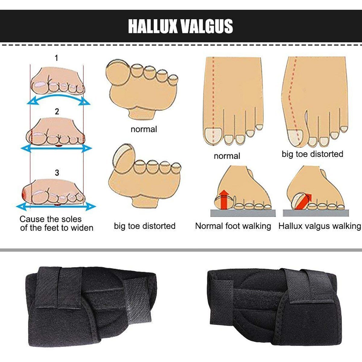 Шина для великого пальця стопи PEDIMENDTM для полегшення болю при вальгусній деформації (2 пари), фото №2