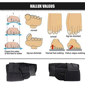 Шина для великого пальця стопи PEDIMENDTM для полегшення болю при вальгусній деформації (2 пари) synthetic.ua - Фото 1