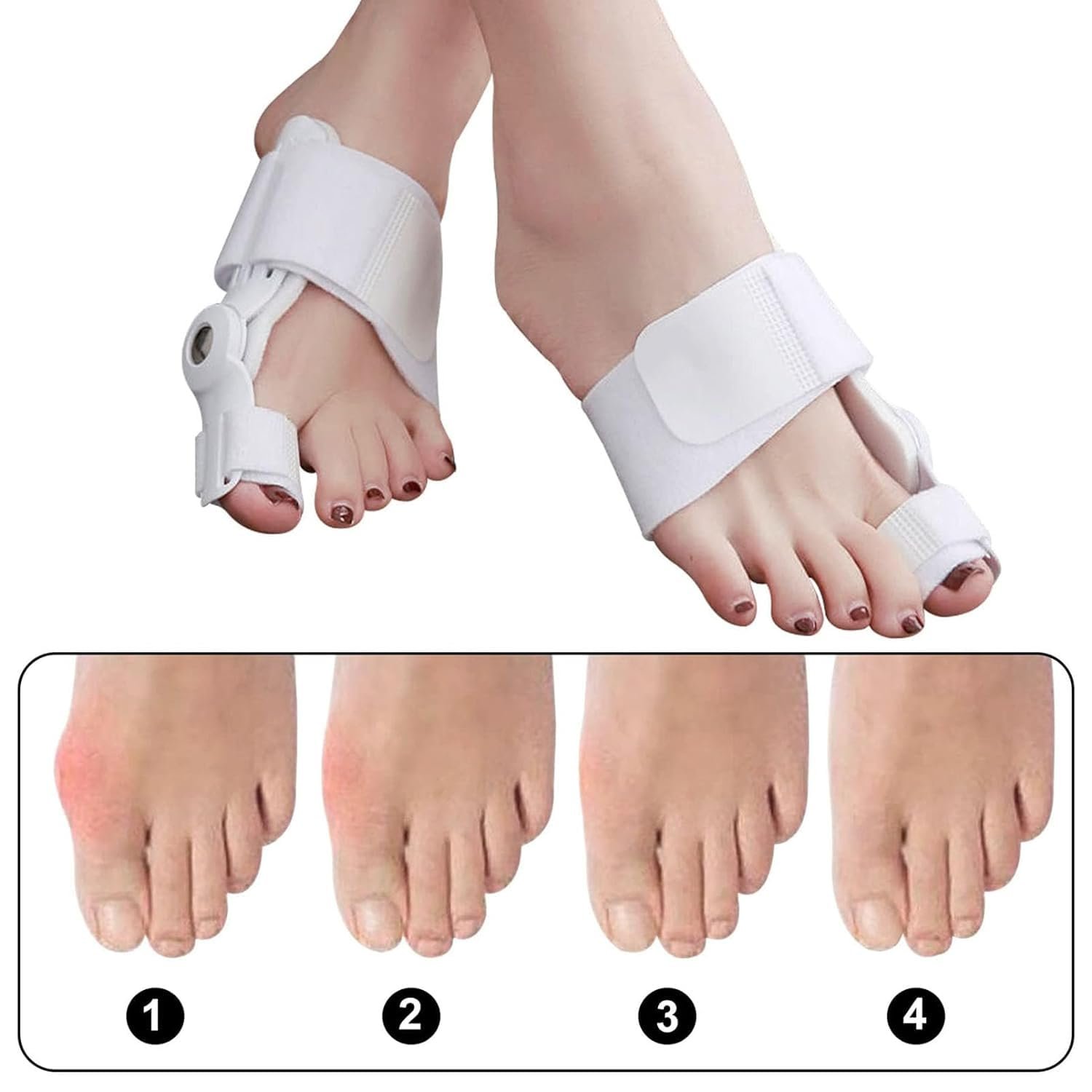 Розпірка великого пальця стопи для чоловіків і жінок, 1 пара, коректор вальгусної деформації, регульована, фото №7