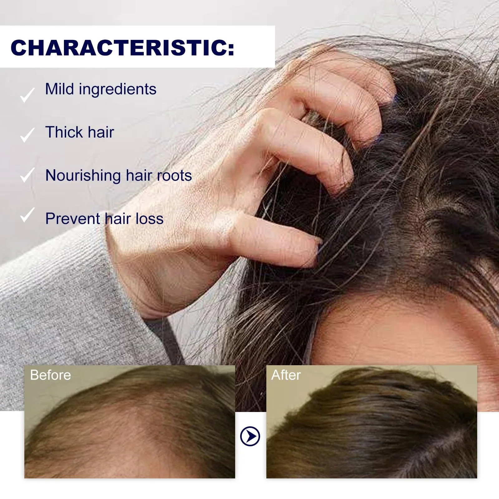 Олія Догляд за волоссям, Ролик для росту волосся, Сироватка проти випадіння волосся, фото №2