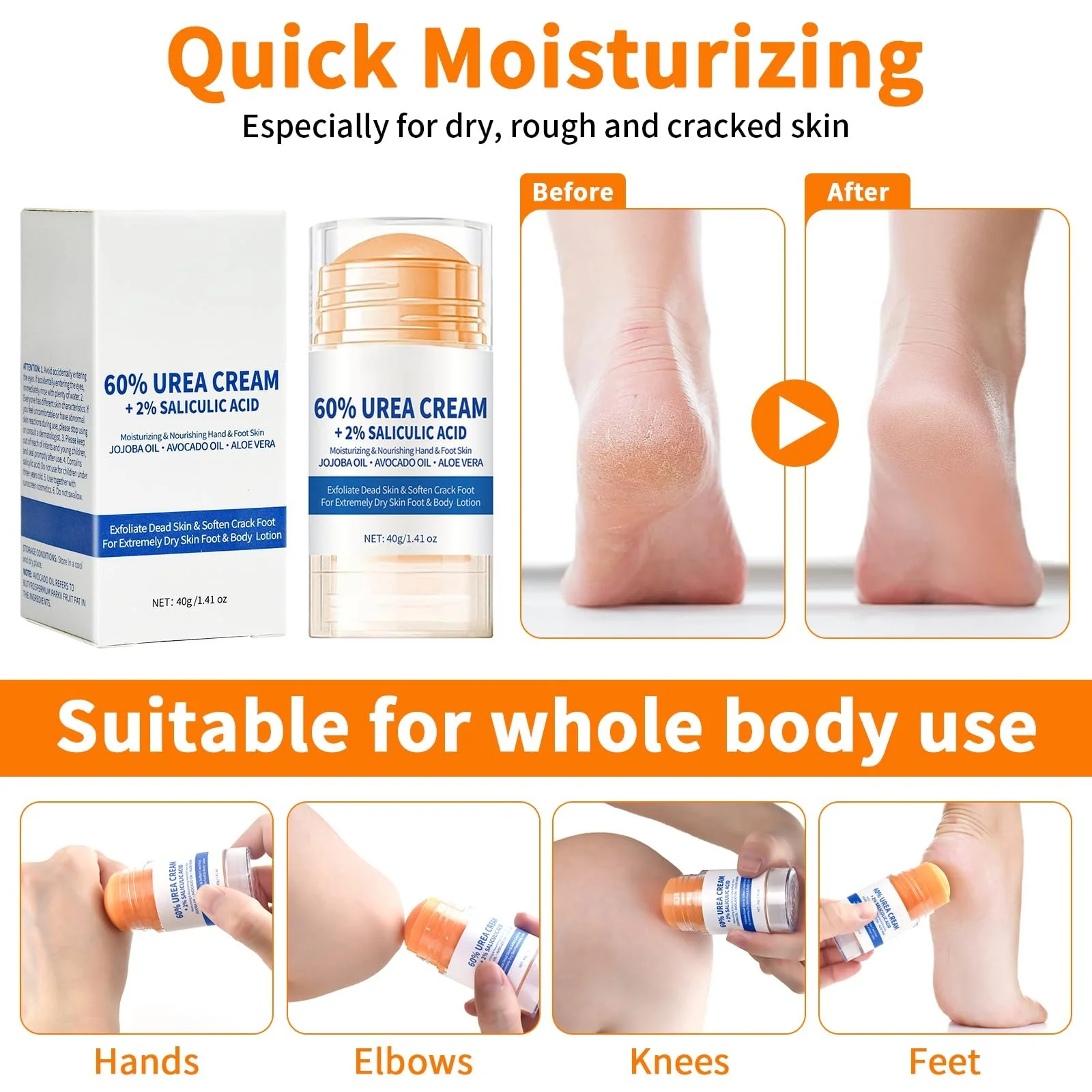 Крем для ног Urea 60% стик с мочевиной и средством для удаления мозолей 2 шт., фото №5 Крем для ног Urea 60% стик с мочевиной и средством для удаления мозолей 2 шт., фото №5