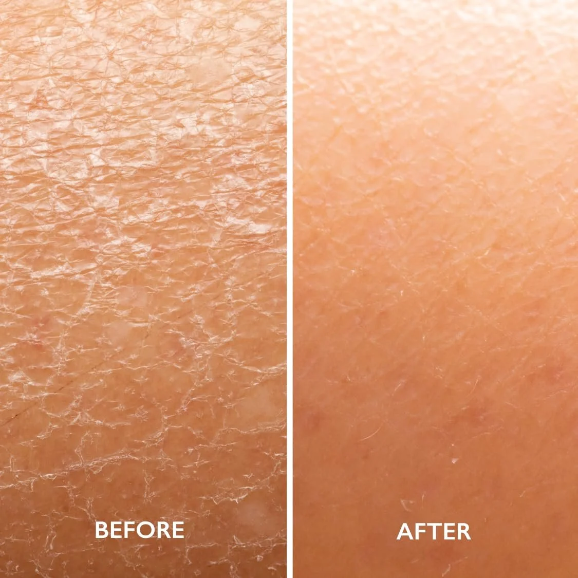 Лосьйон для тіла Gatineau AHA Зволожуючий для сухої шкіри (400 мл x 2 флакони), фото №6